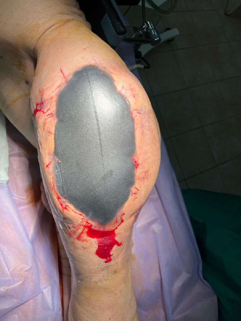 красногорск, медицина, лечение,