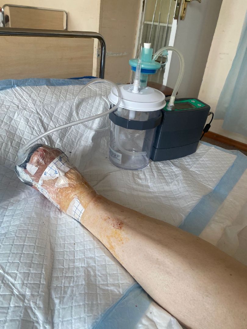 красногорск, медицина, лечение,