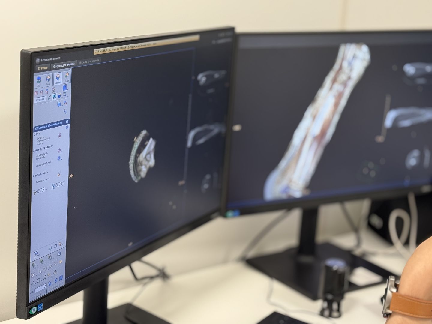 балашихинская больница, КТ-кабинет, филиал 3 Балашихинской больницы,