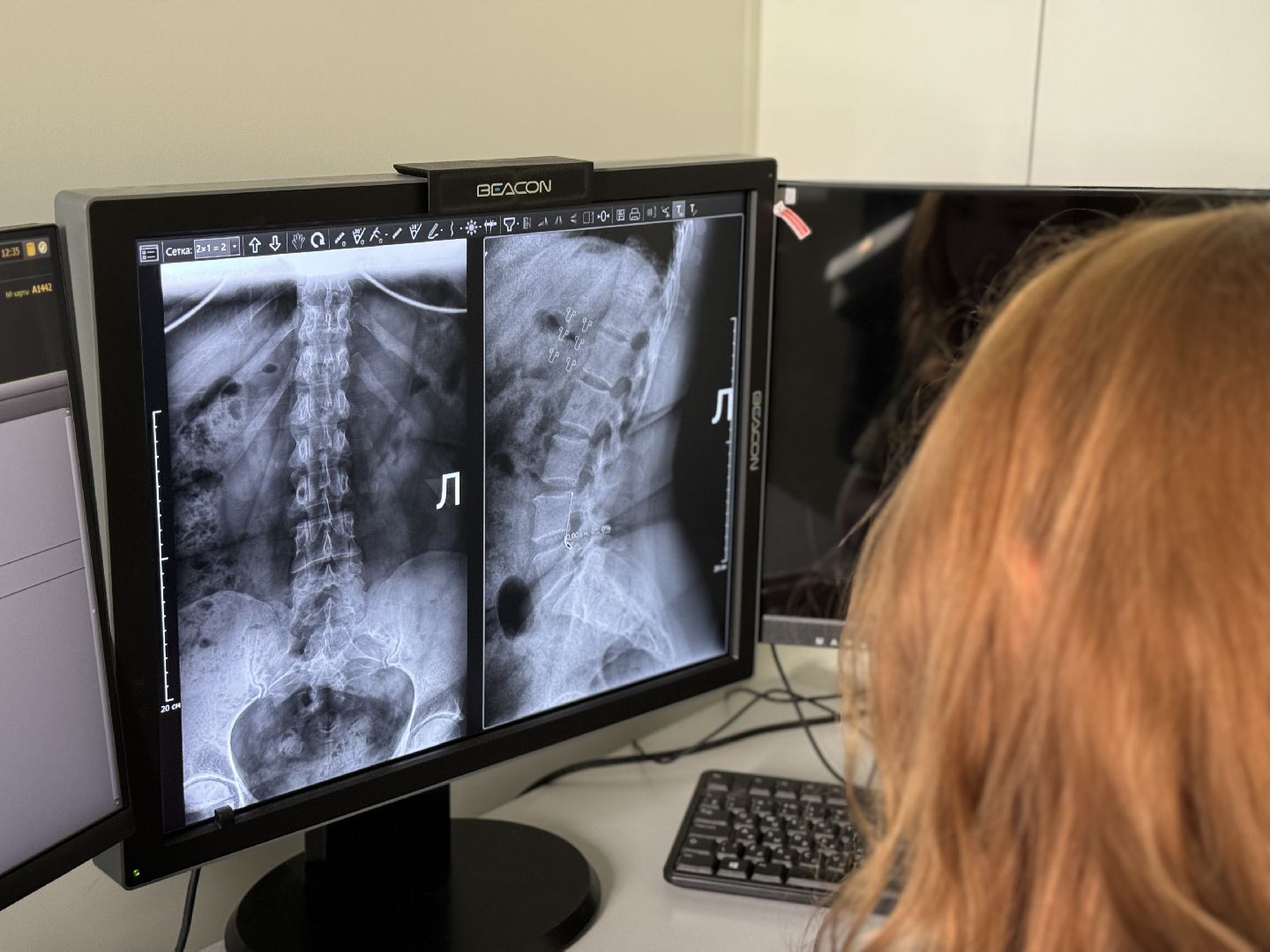 новый рентген аппарат, поликлиника , ленинский городской округ, видновская клиническая больница,жк бутово парк ,