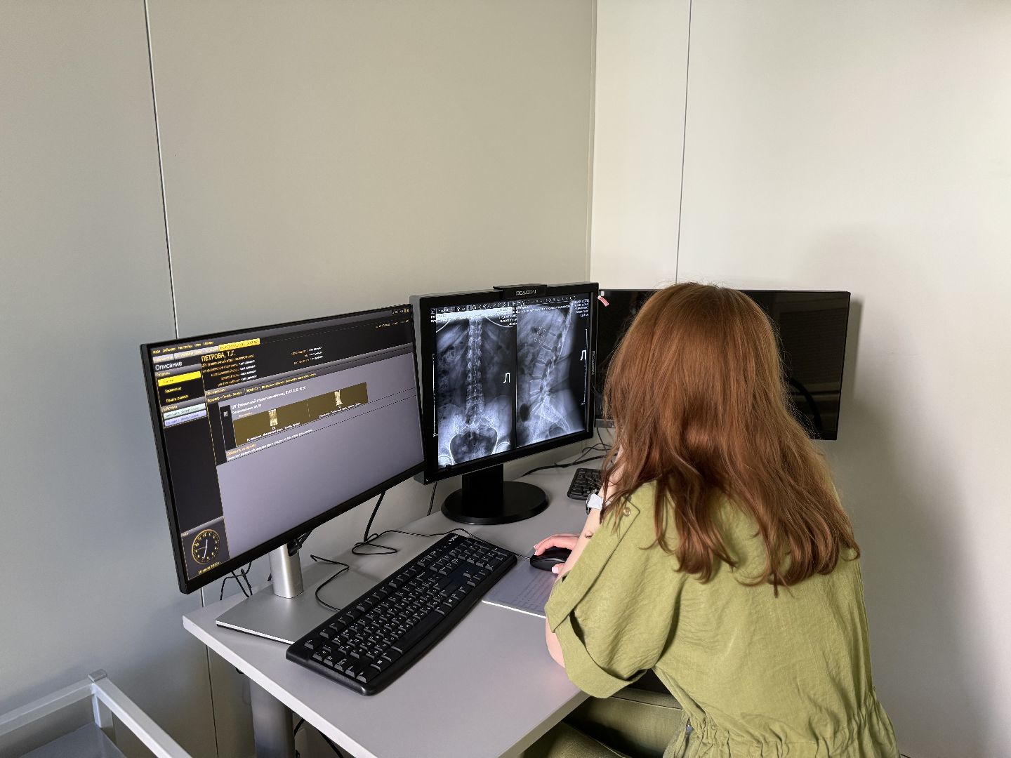 новый рентген аппарат, поликлиника , ленинский городской округ, видновская клиническая больница,жк бутово парк ,