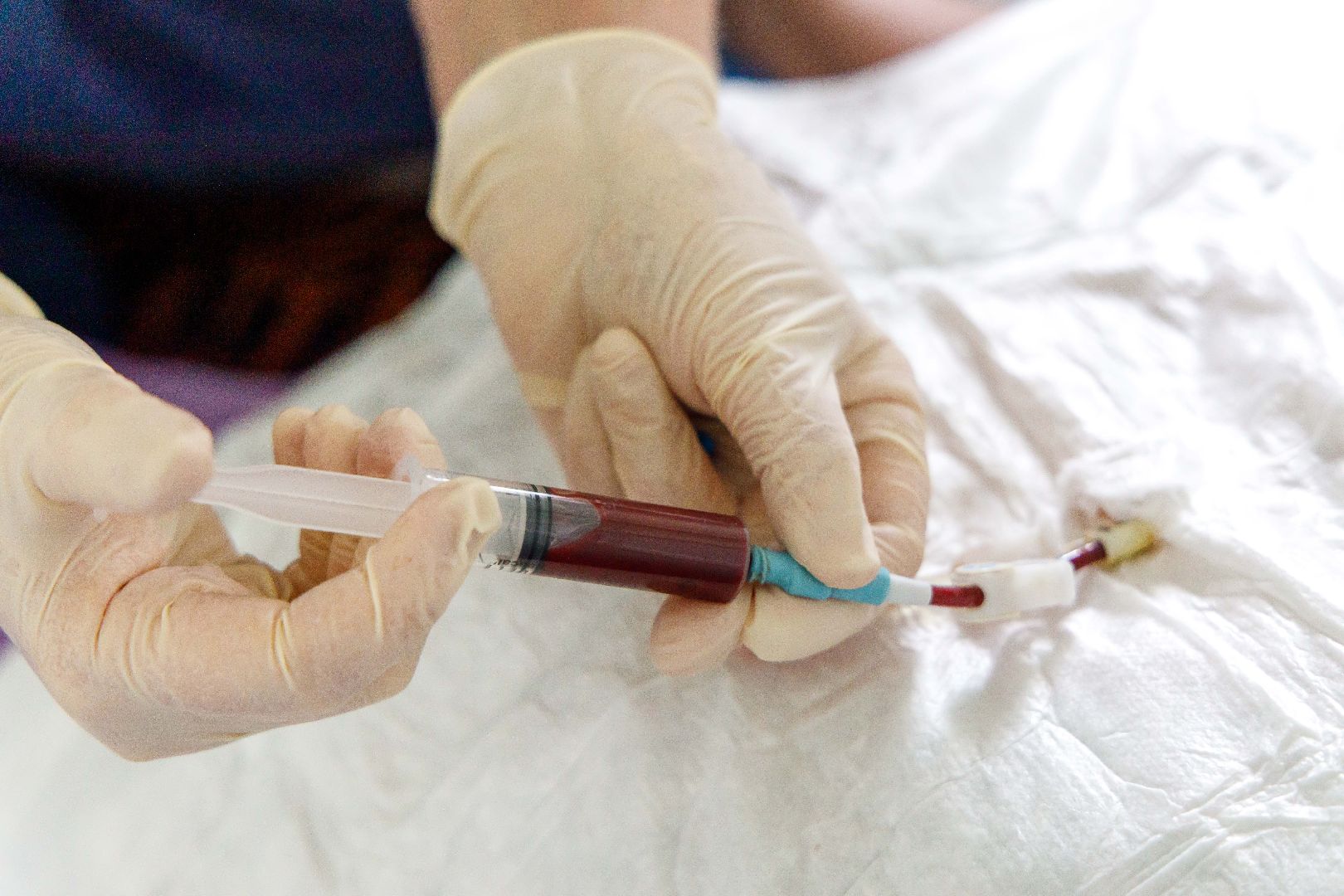 Люберцы, люберецкая больница, диализ, нефрологический центр,