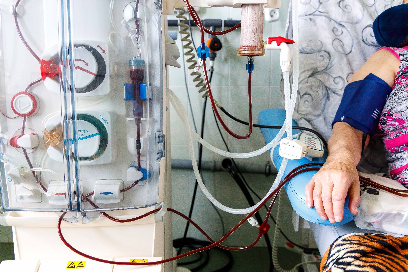 Люберцы, люберецкая больница, диализ, нефрологический центр,