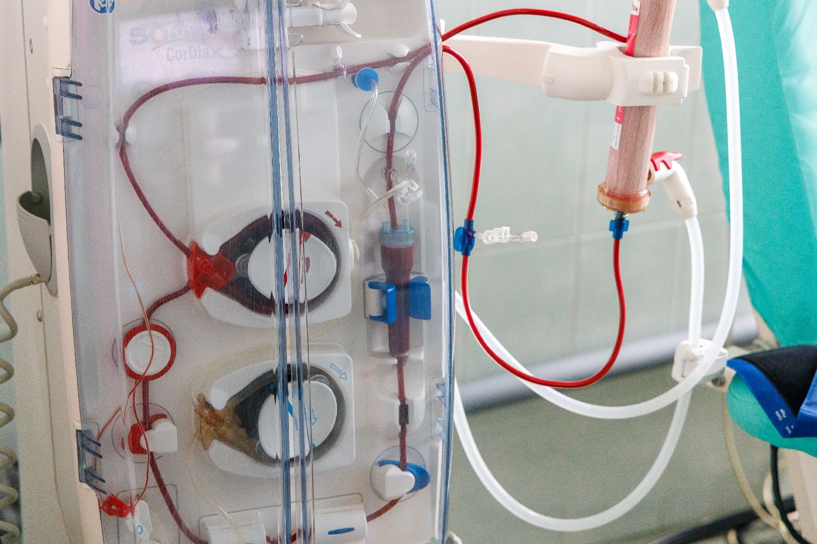 Люберцы, люберецкая больница, диализ, нефрологический центр,