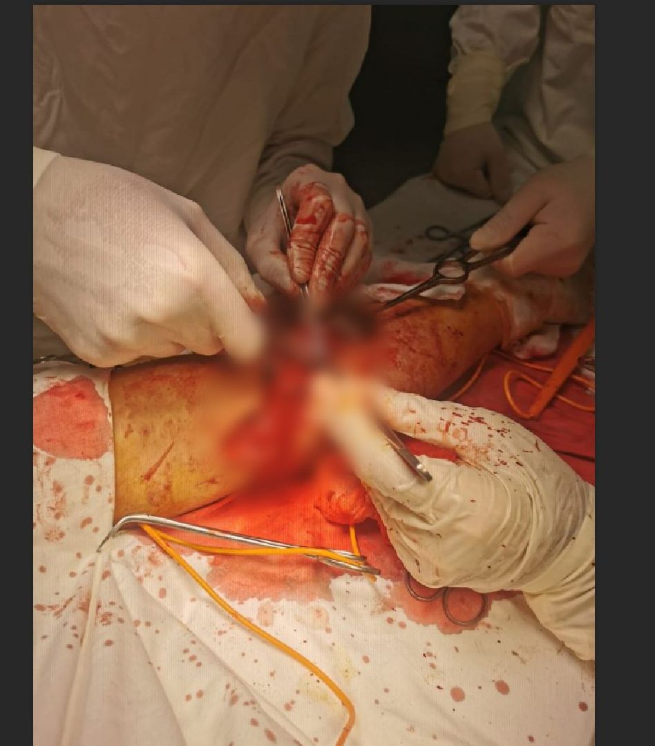 Солнечногорск, хирургия, операция, медицина, больница