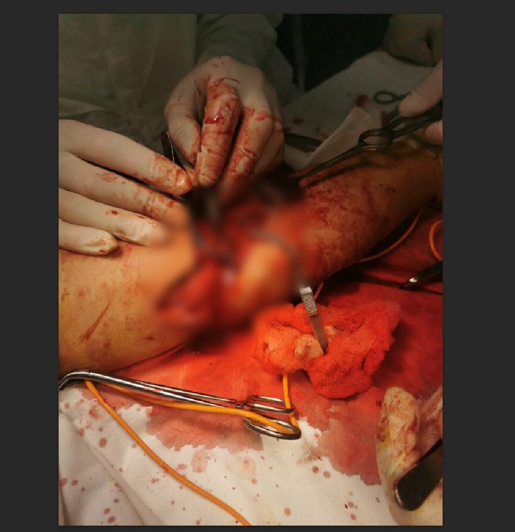 Солнечногорск, хирургия, операция, медицина, больница