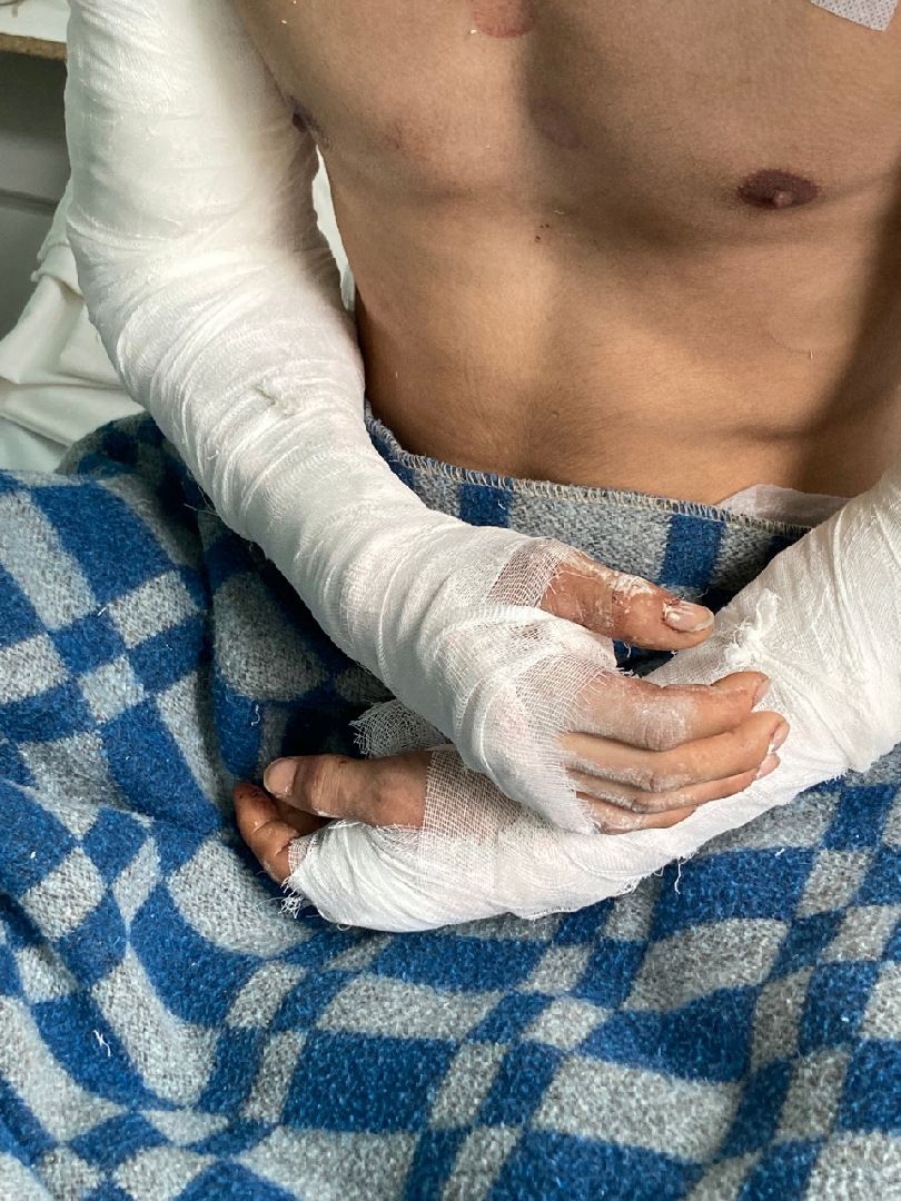 Солнечногорск, хирургия, операция, медицина, больница