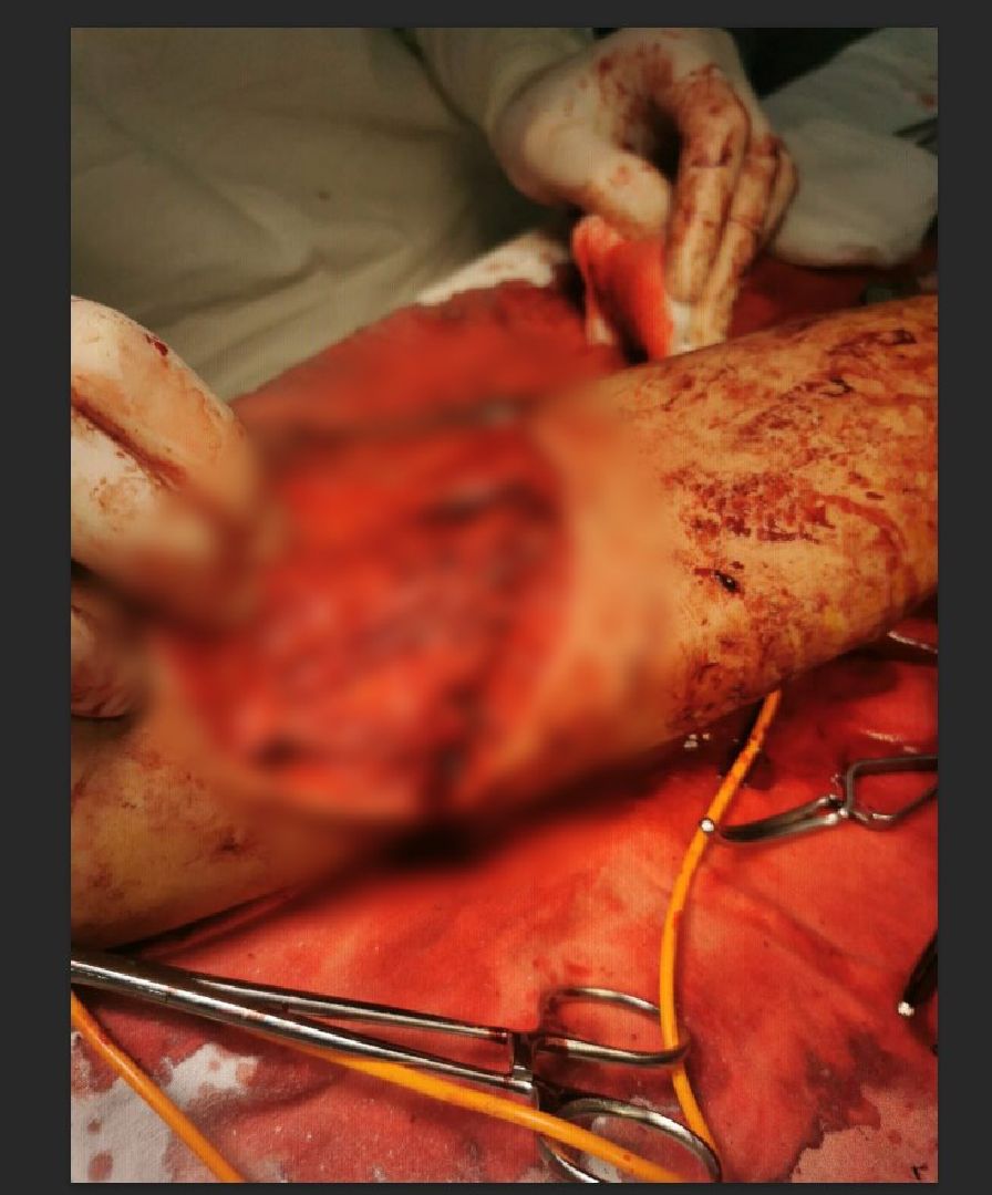 Солнечногорск, хирургия, операция, медицина, больница