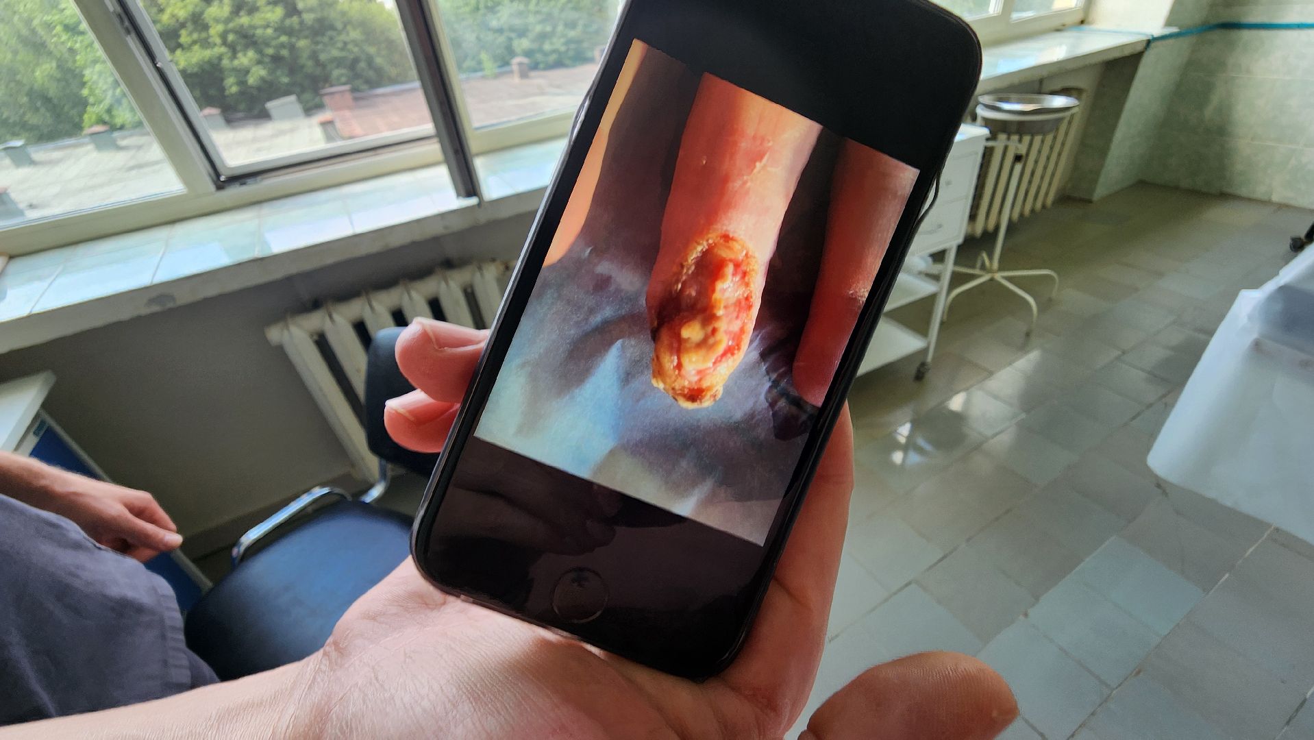 солнечногорск, медицина, травматология, операция,