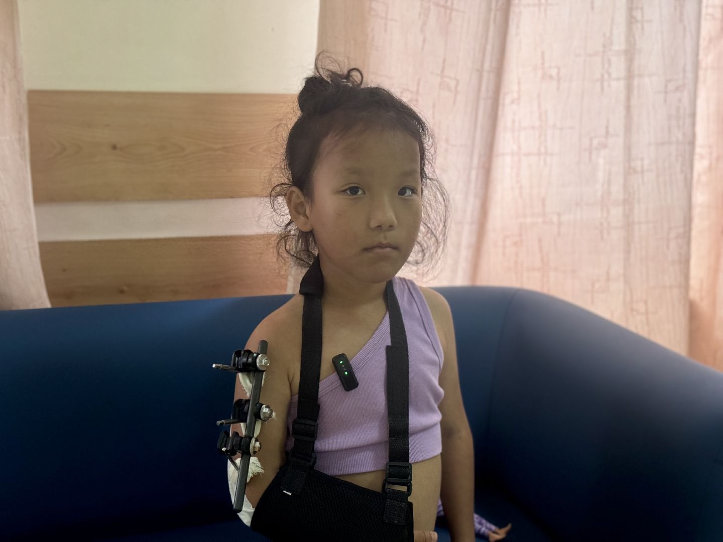 врачи спасли , видновская клиническая больница, перелом руки, врач травматолог-ортопед,