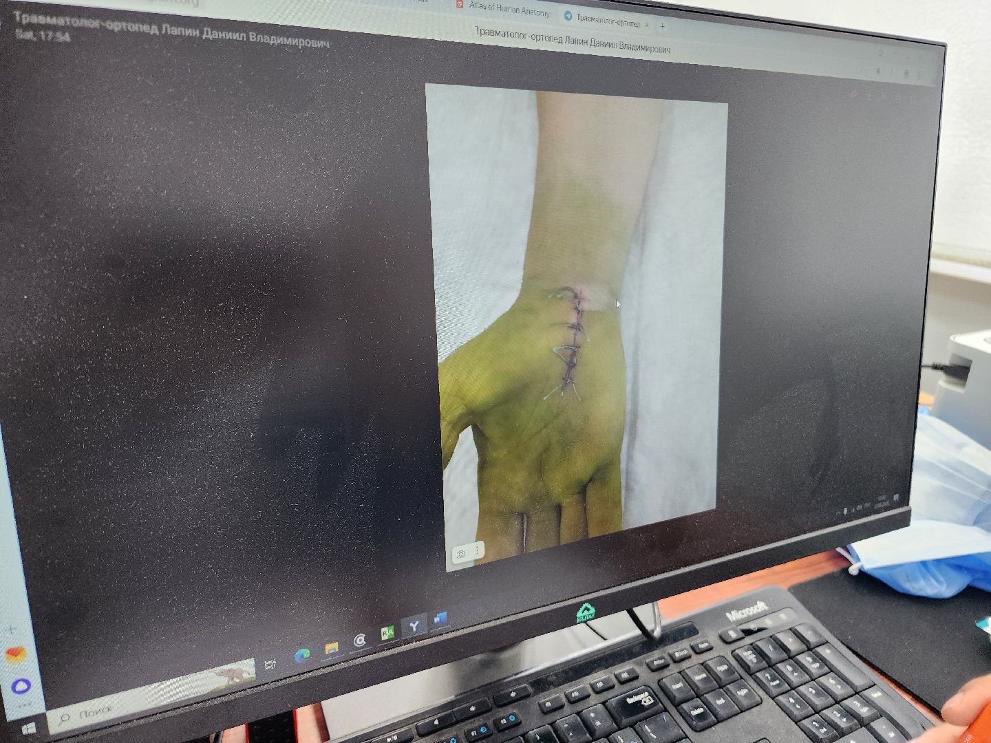 фрязино, врач-травматолог, сложная операция, медицина,