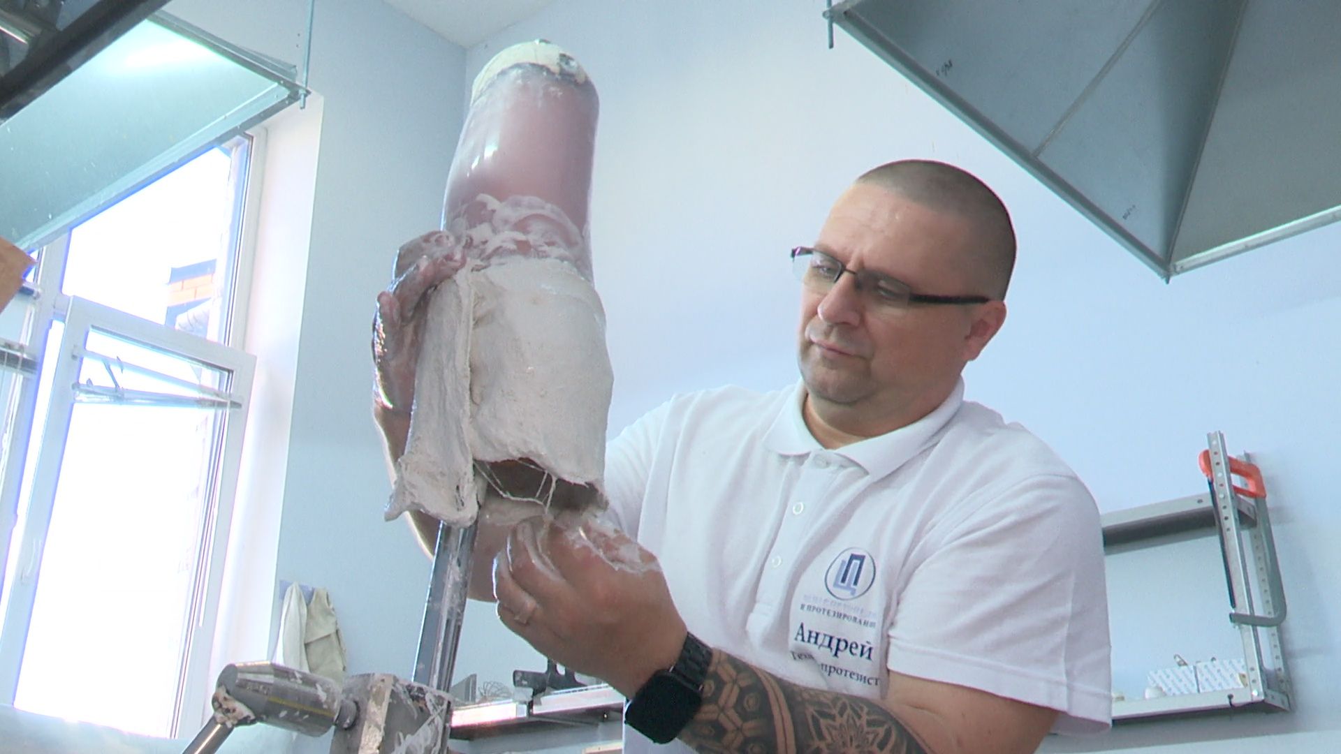 реутов, протез, сво,