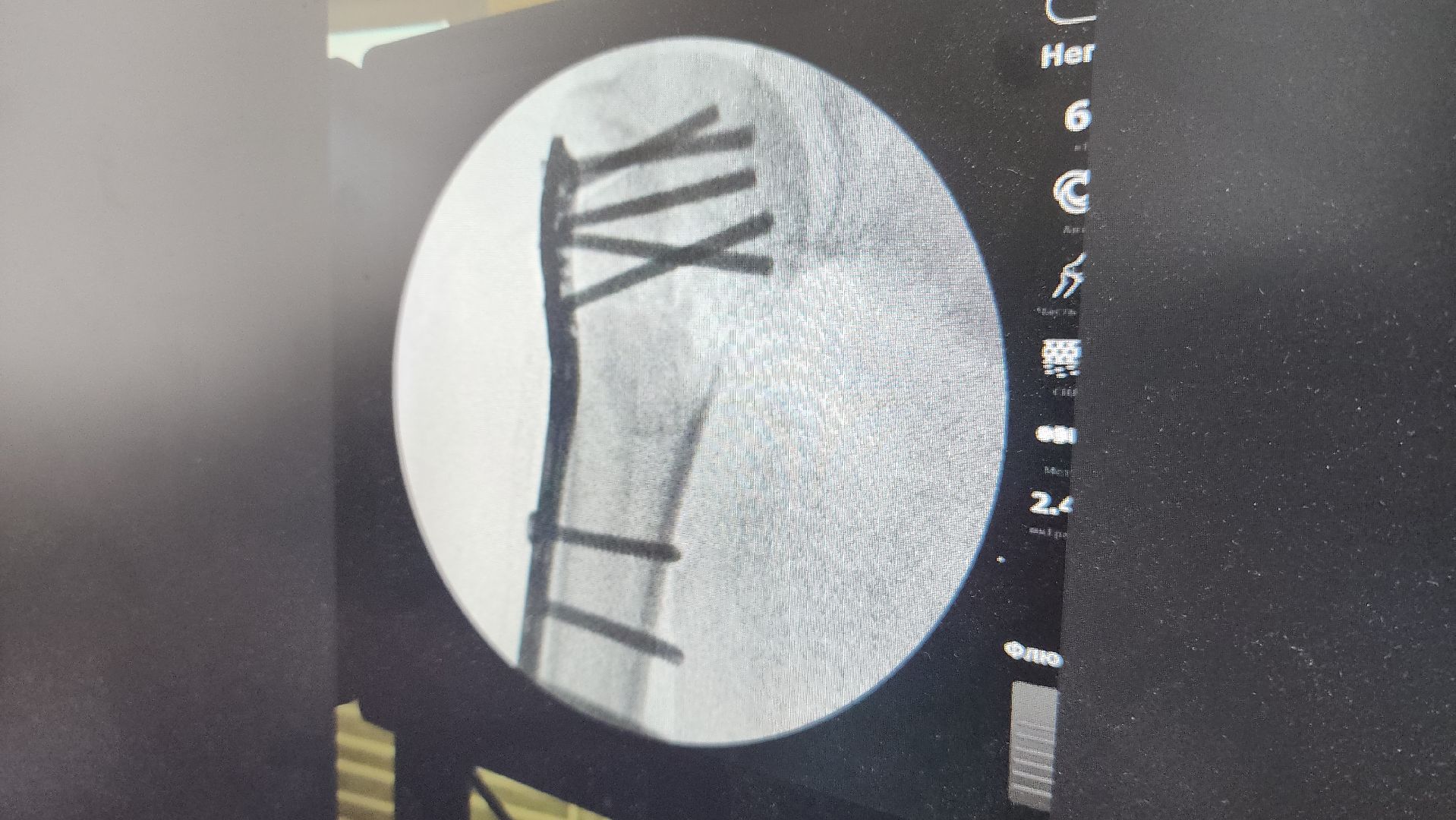 волоколамск, хирургия, больница,