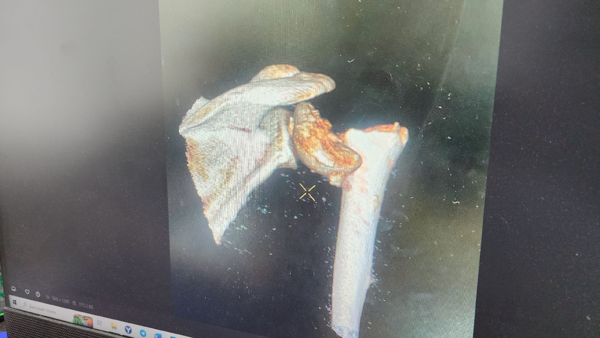 волоколамск, хирургия, больница,