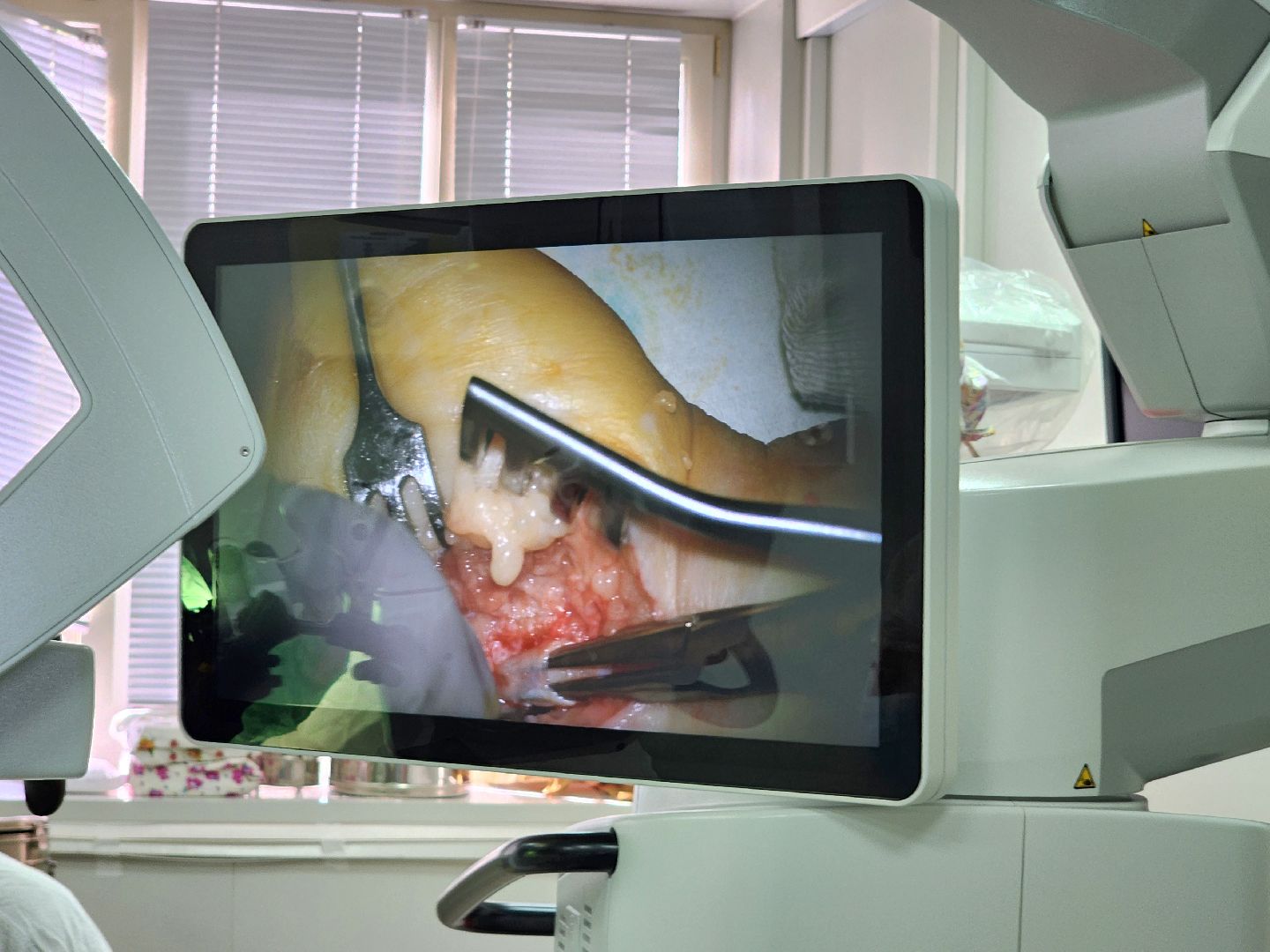 наро-фоминский городской округ, наро-фоминская областная больница, микроскоп , Травматология ,Операционный микроскоп, Здравоохранение Подмосковья ,