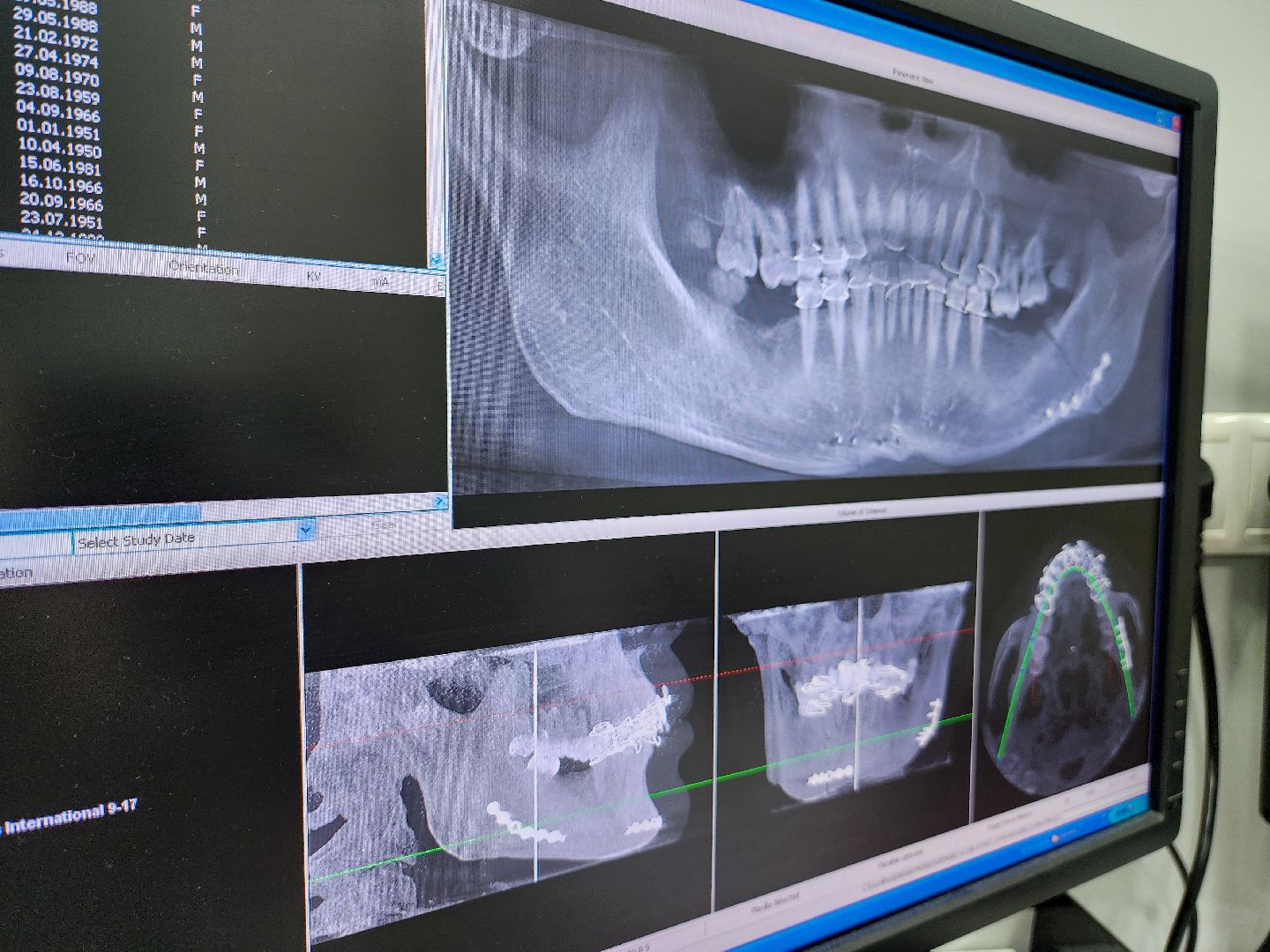 Подольск, Стоматология, медицина подмосковья, Модернизация поликлиники,