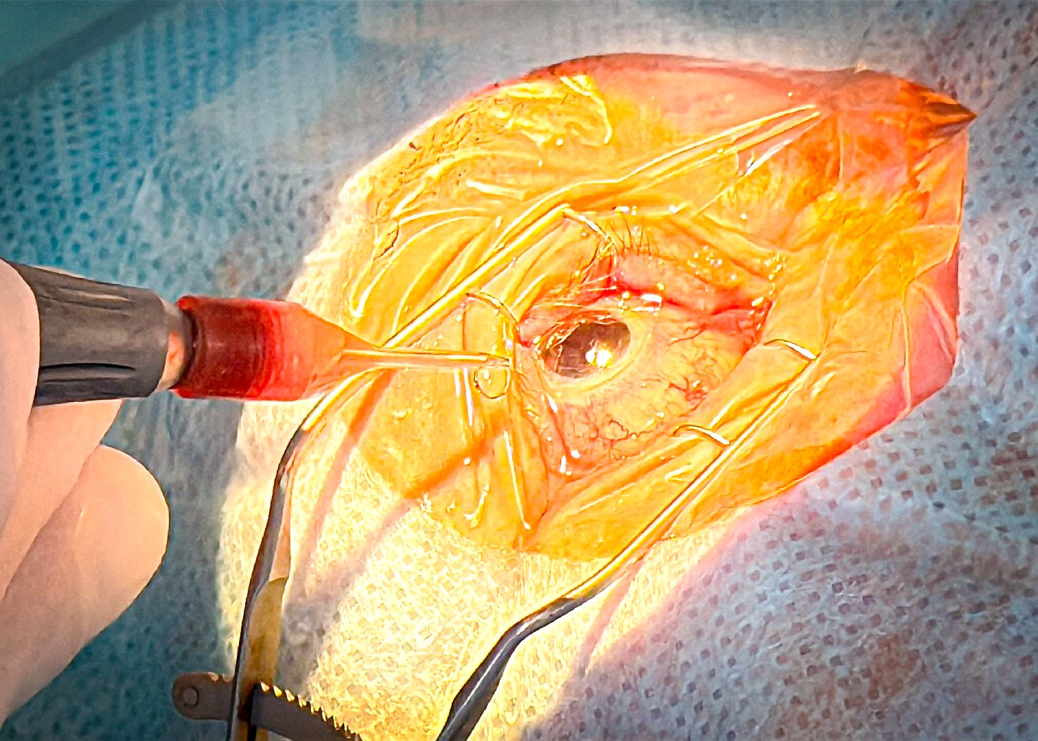 клин, общество, медицина, офтальмология, подмосковье, здоровье, зрение,