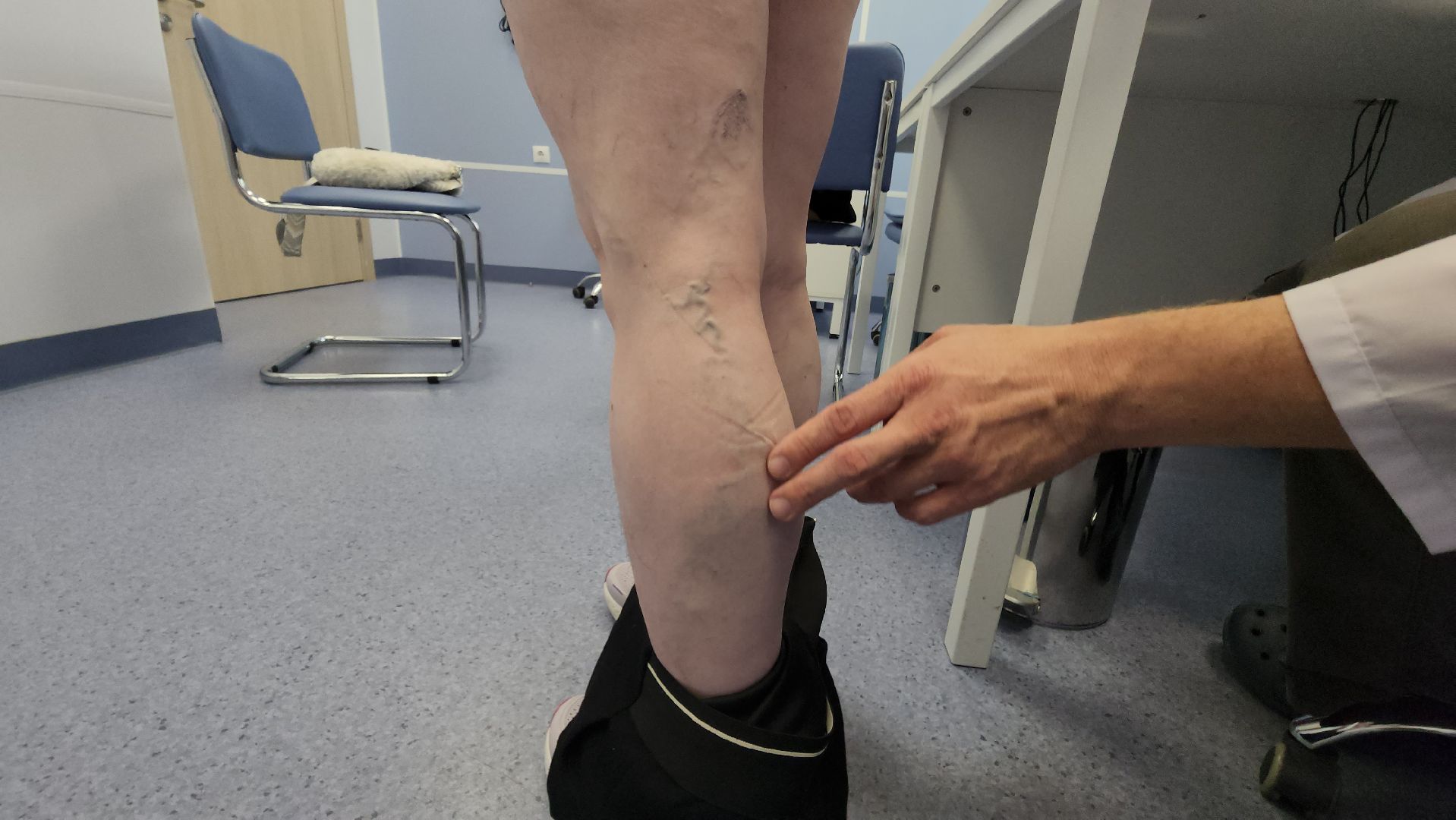 Истра, Медицина, Варикоз,