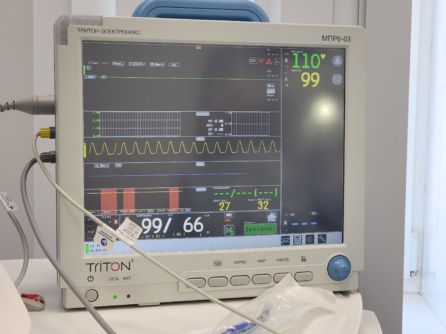 Подольск , бородино, детская больница, Новое оборудование , реанимационное отделение,
