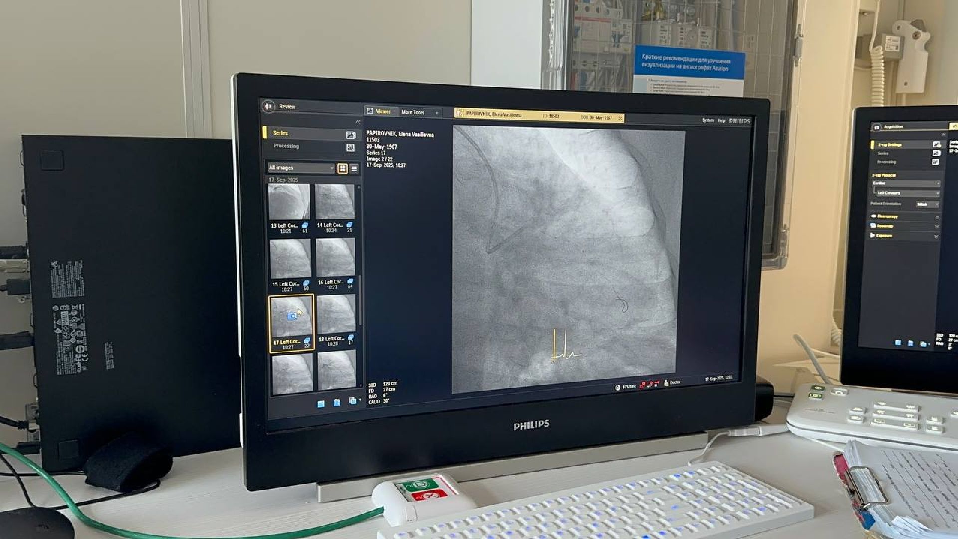 медицина, сосудистый центр, домодедово,