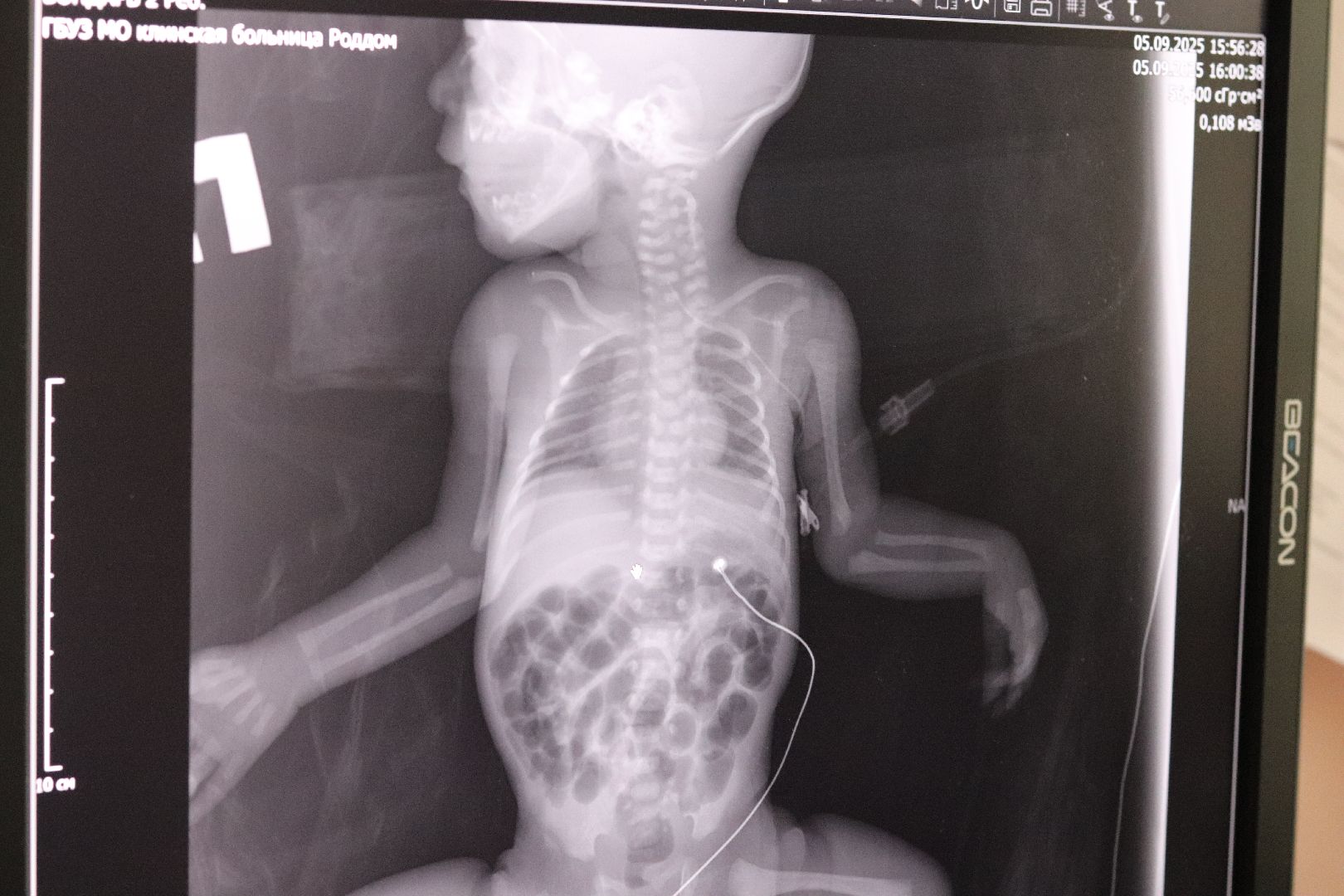 клин, общество, медицина, новое медицинское оборудование, дети, клинский роддом,