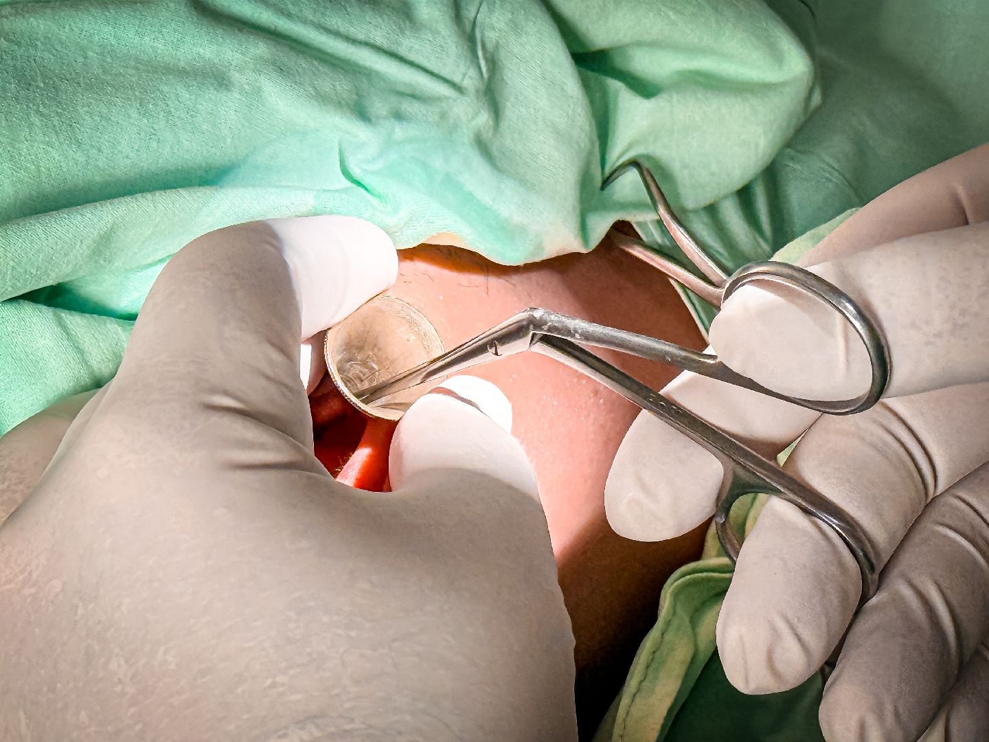 клин, общество, медицина, уникальные операции,