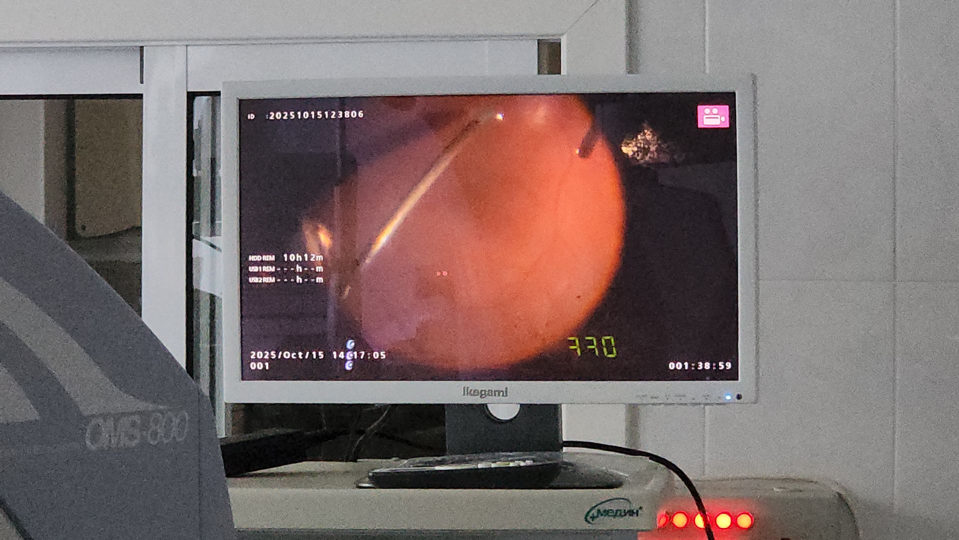 красногорск, медицина, больница, новое оборудование,офтальмология,