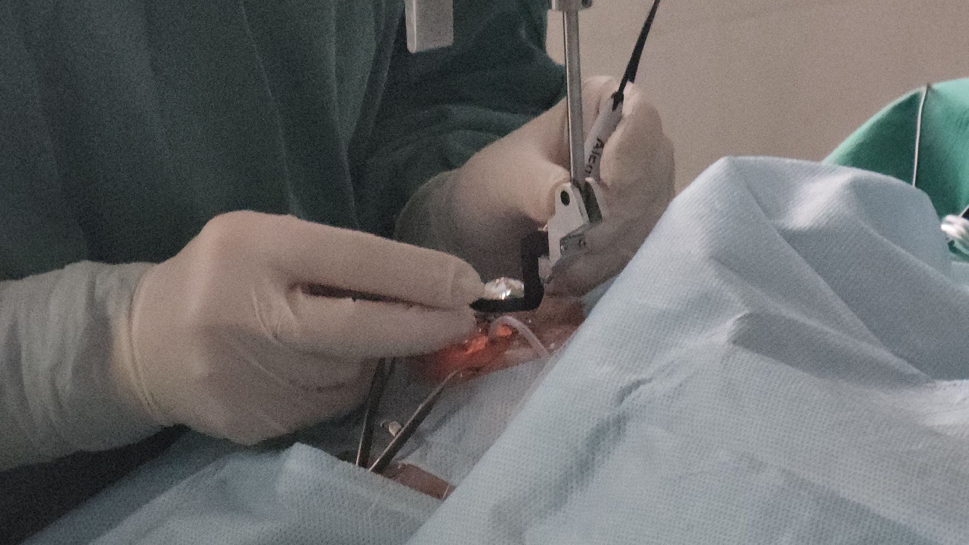 красногорск, медицина, больница, новое оборудование,офтальмология,