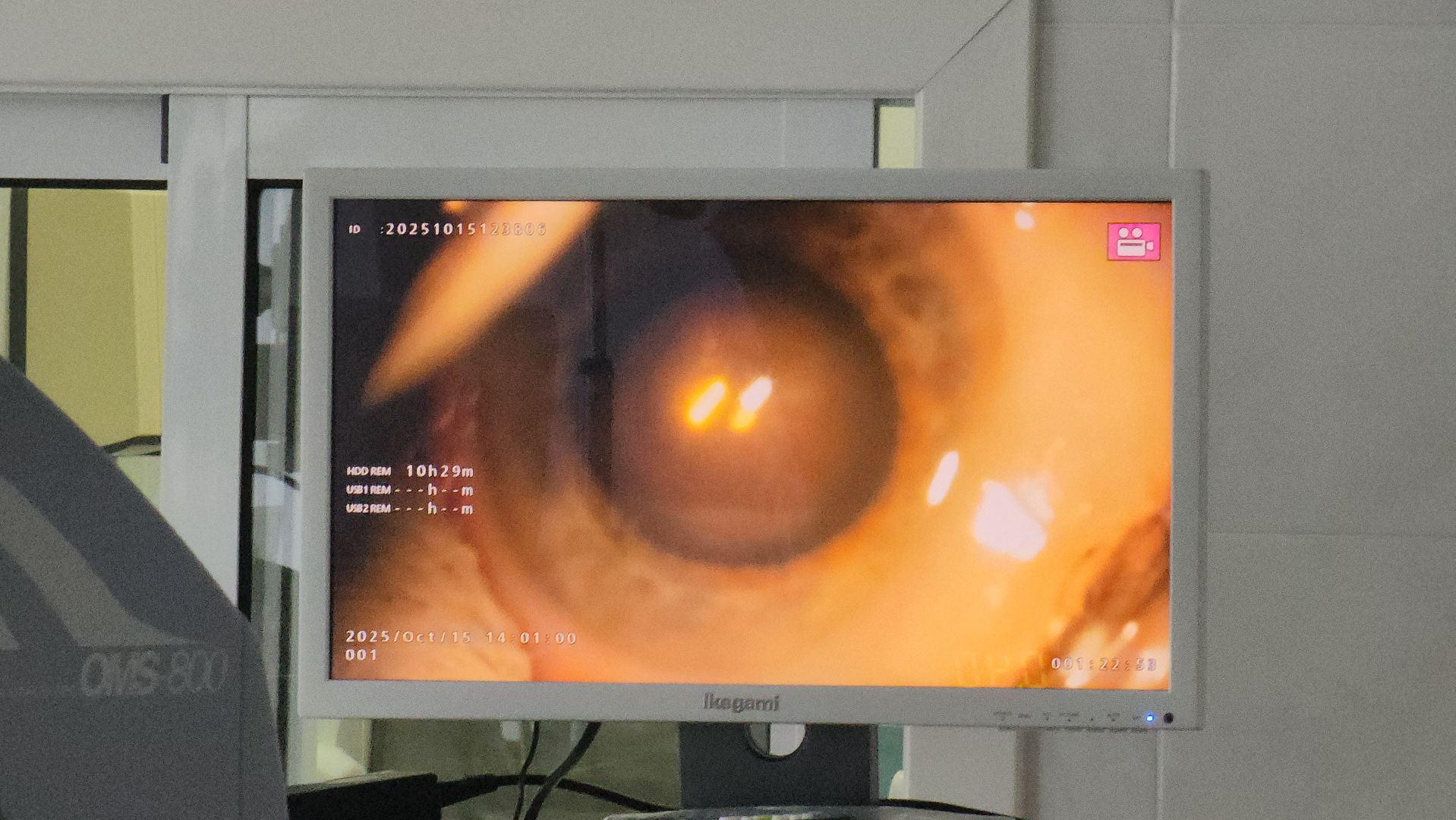 красногорск, медицина, больница, новое оборудование,офтальмология,