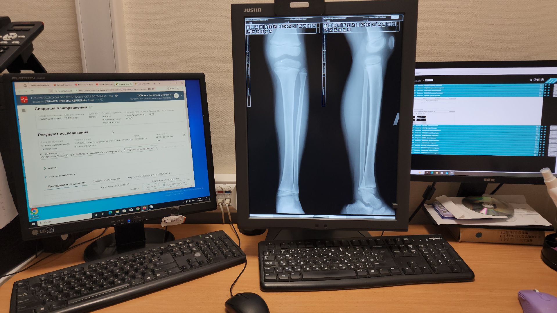 кашира, каширская больница, поликлиника , рентген, рентгенолог, новый врач, медицина, здравоохранение,