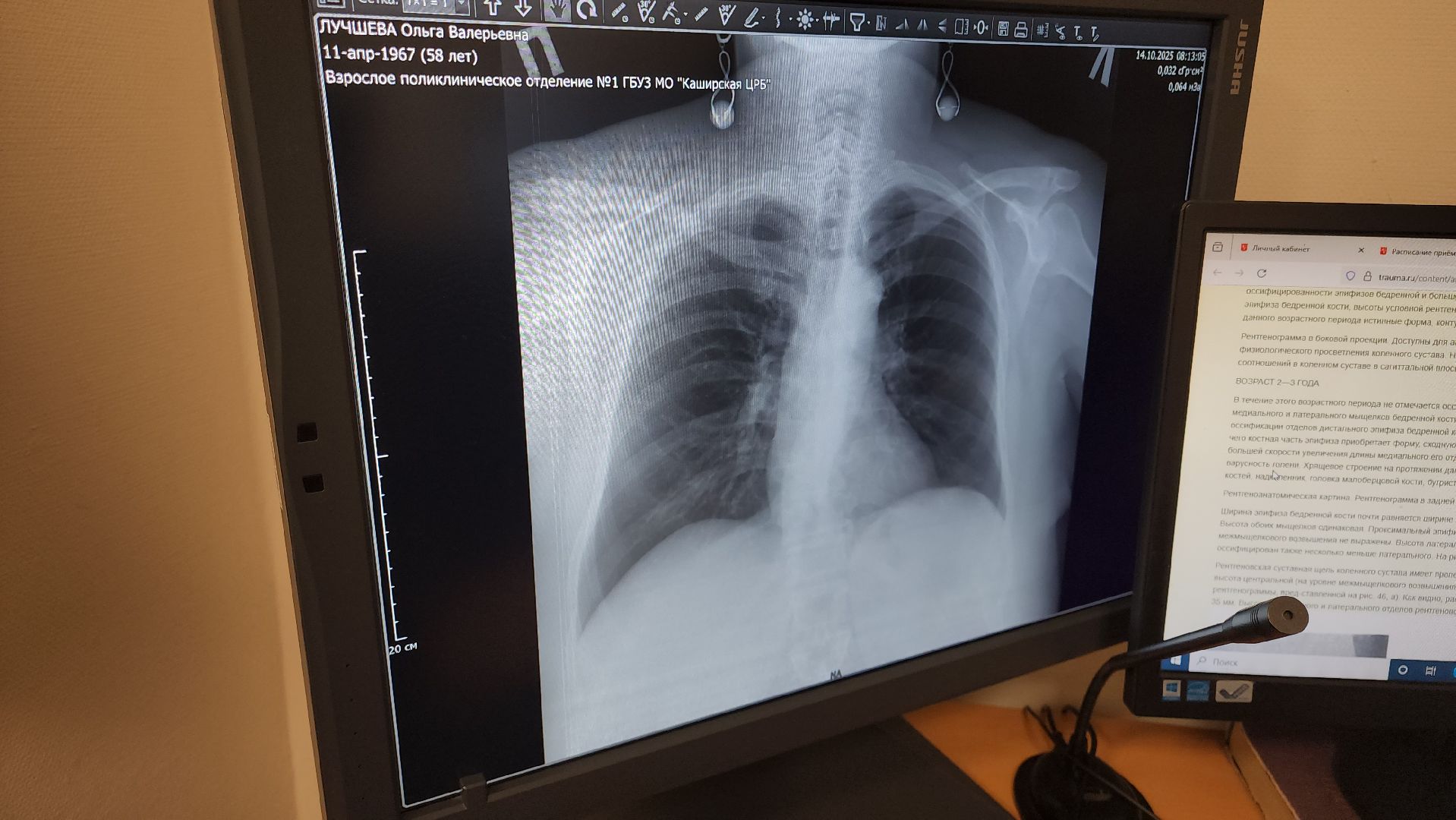 кашира, каширская больница, поликлиника , рентген, рентгенолог, новый врач, медицина, здравоохранение,