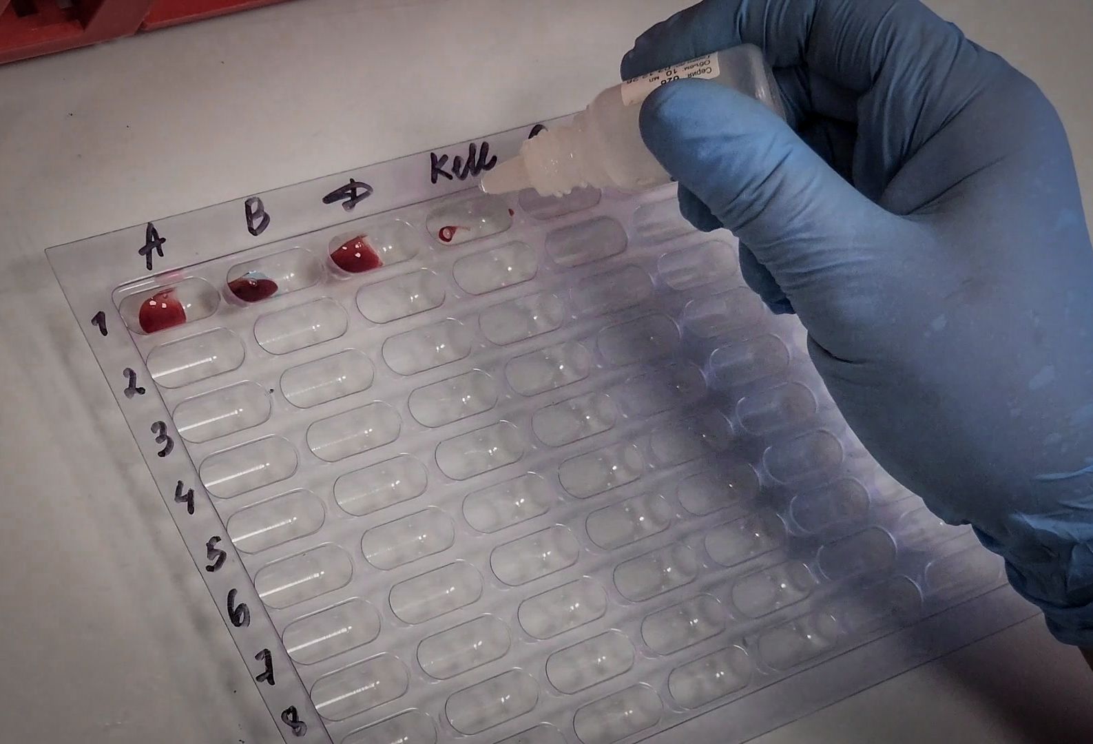 бронницы, кабинет неотложной помощи в бронницах, график работы кабинета неотложной помощи ,неотложная помощь в бронницах,