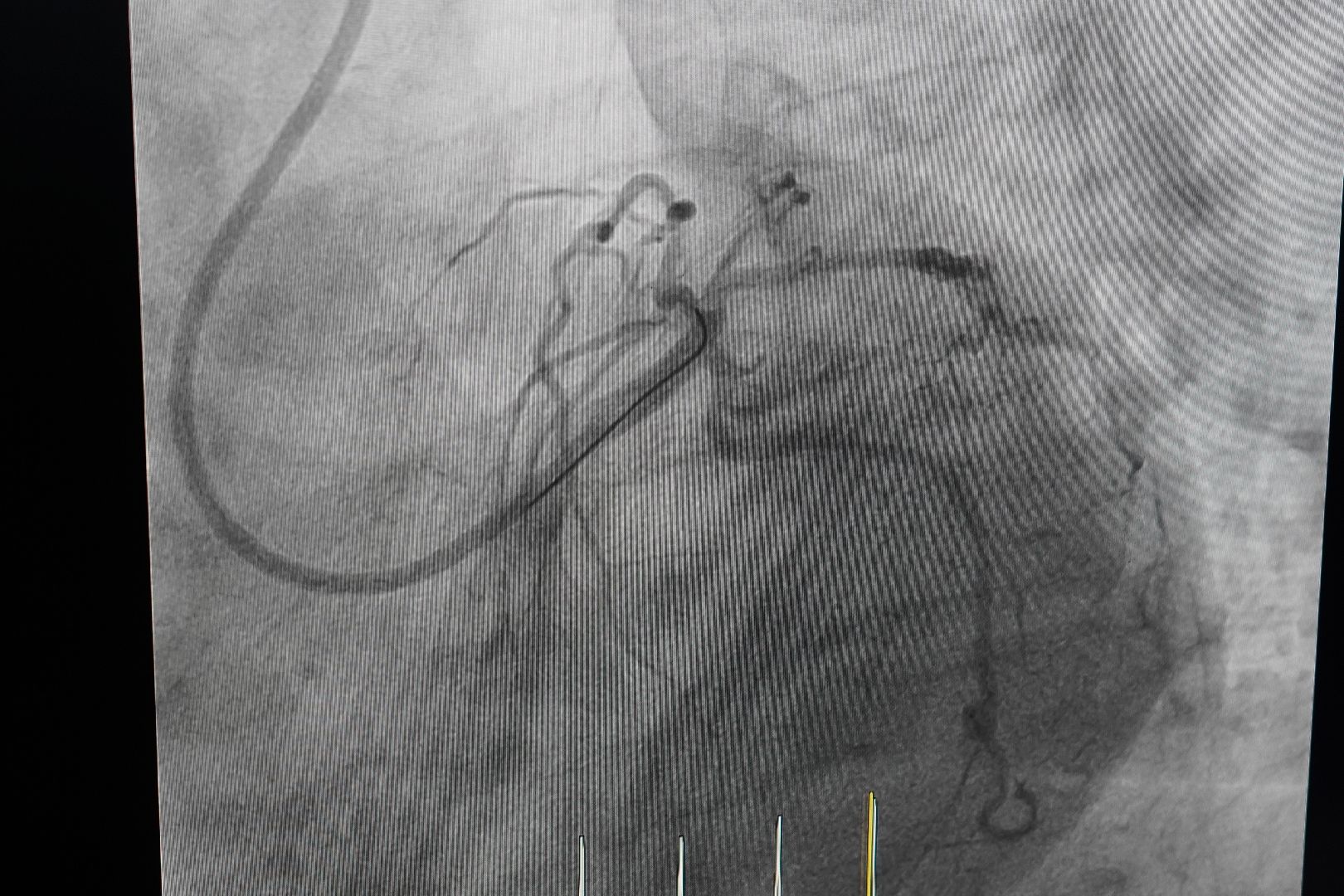 ступино, больница, операция, хирург,