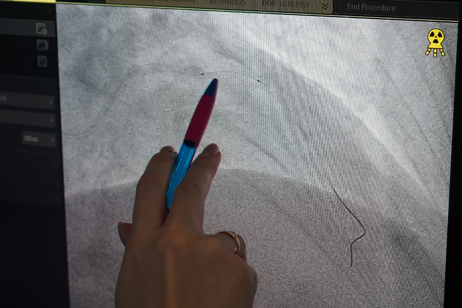 ступино, больница, операция, хирург,