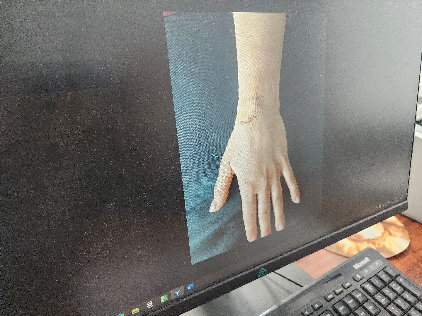 фрязино, суставы, медицина, лечение, профилактика,