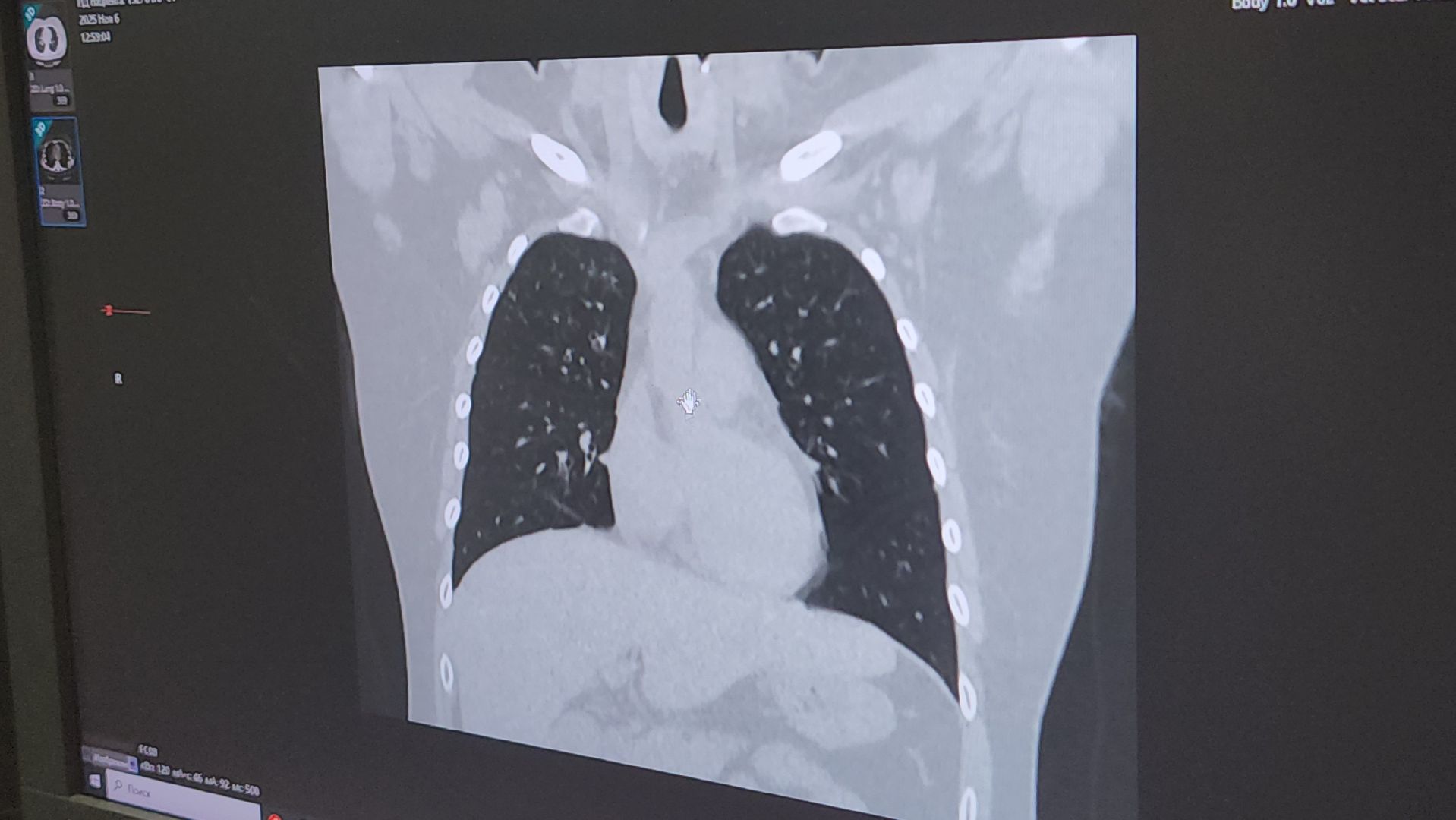 Люберцы, люберецкая больница, школьники, медицинские классы, красково,