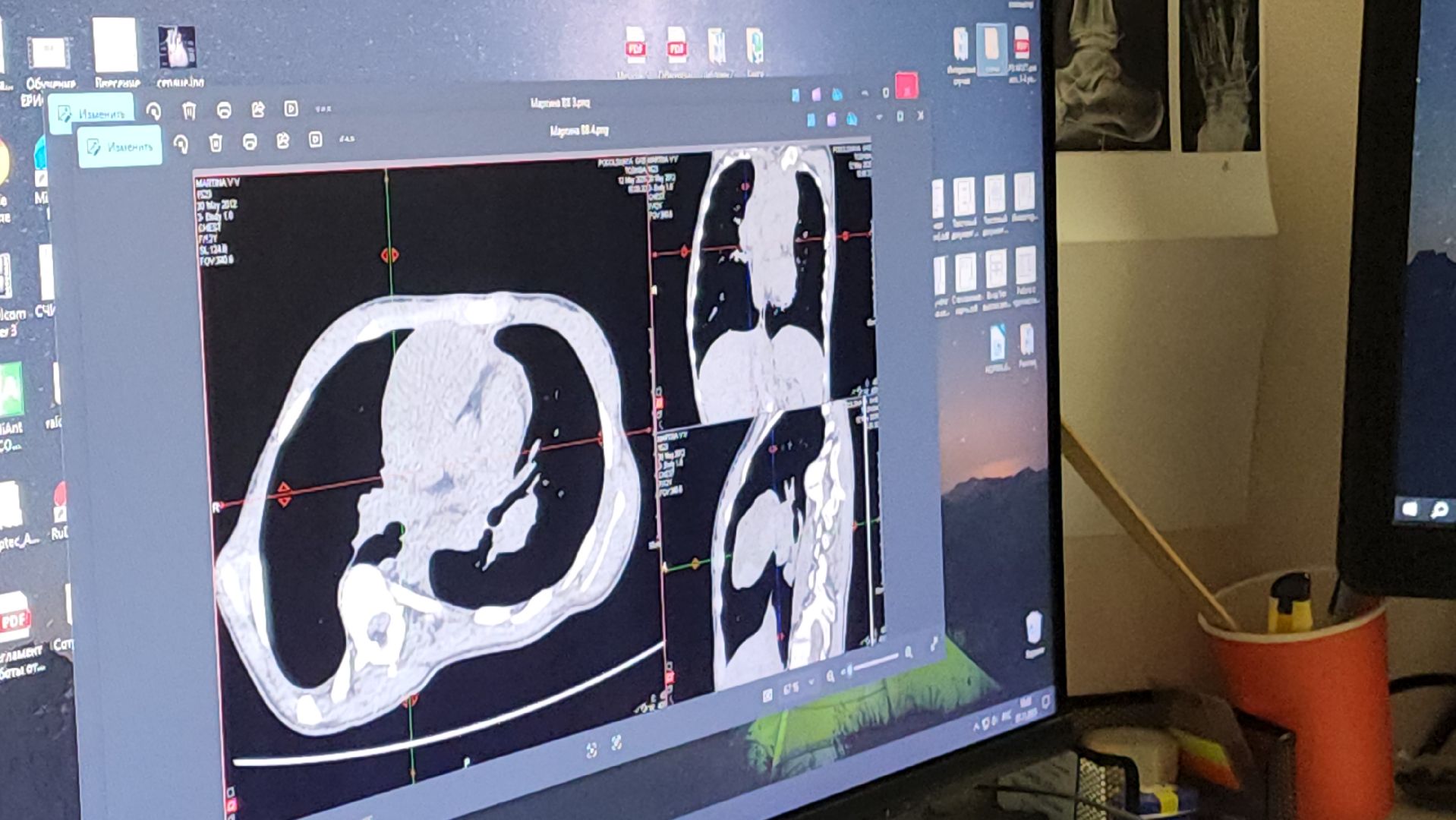 Подольск , подольская детская больница, Бородино,