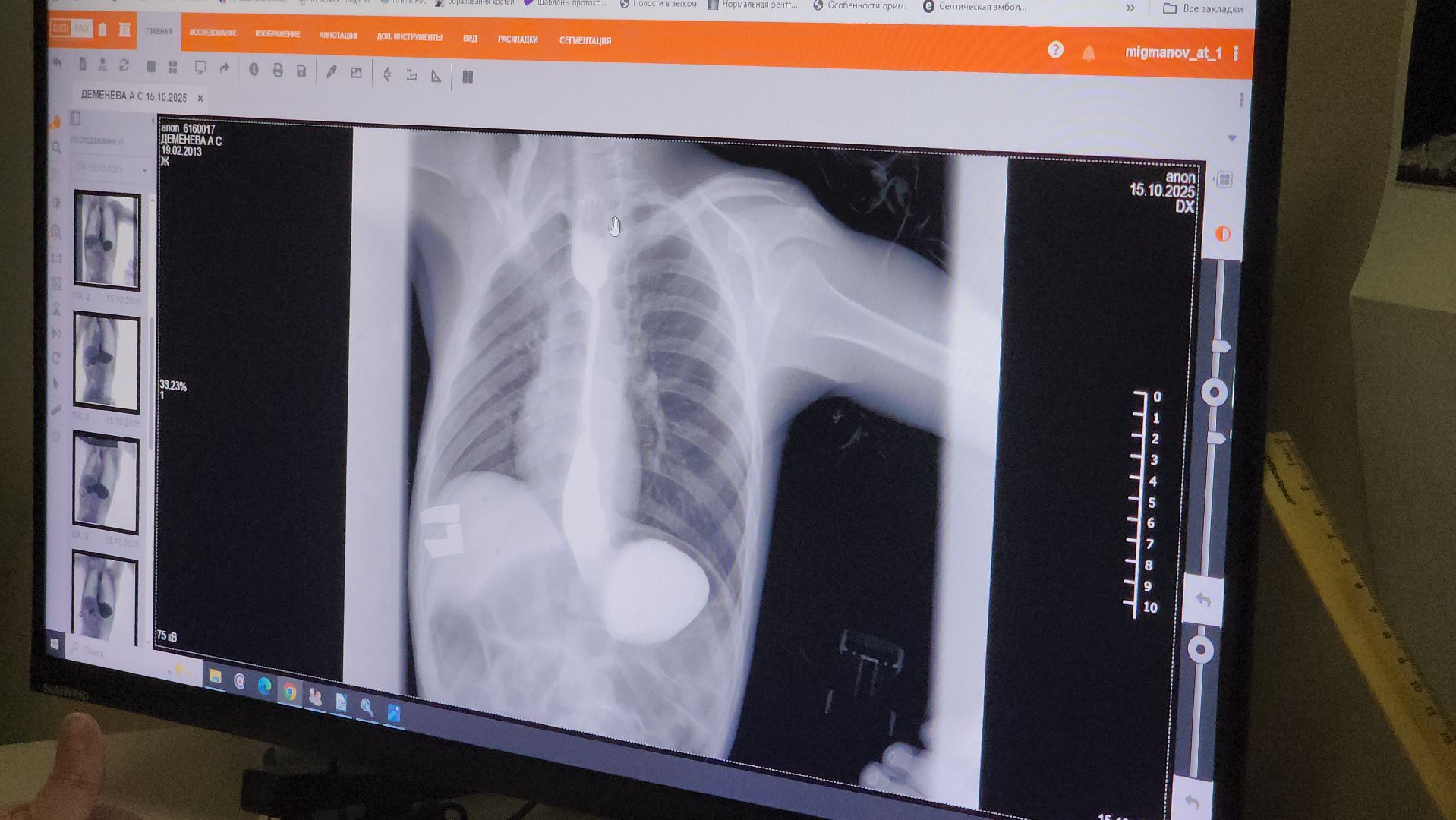 Подольск , Врач-рентгенолог , Праздник, подольская детская больница,