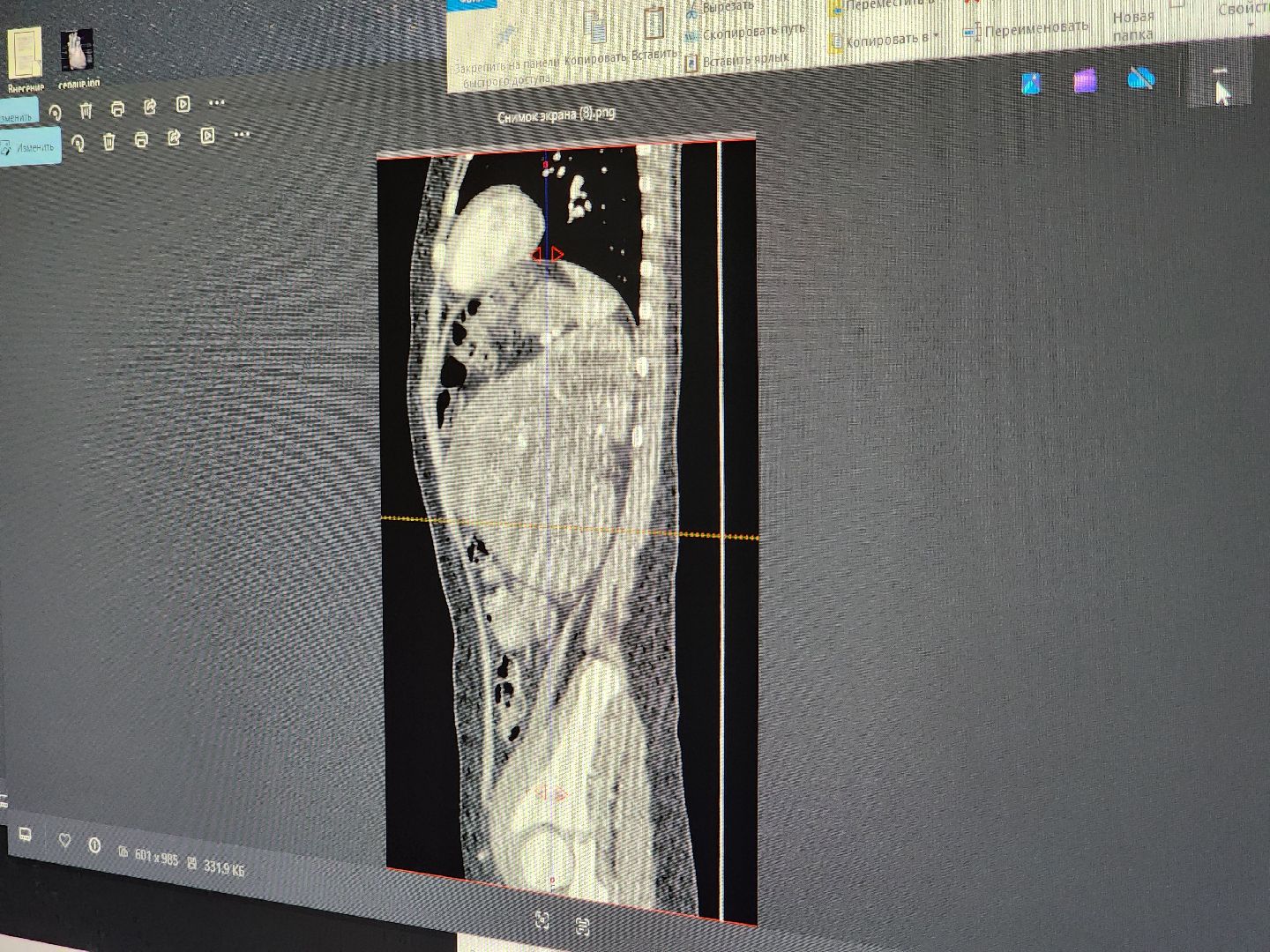 Подольск , Врач-рентгенолог , Праздник, подольская детская больница,