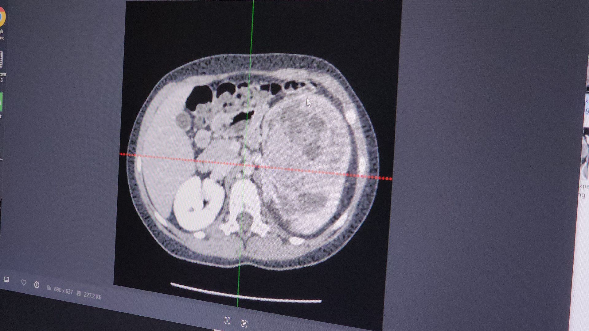 Подольск , Врач-рентгенолог , Праздник, подольская детская больница,