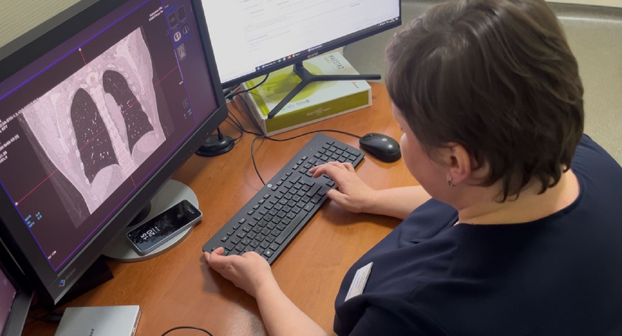 День рентгенолога, шатура медицина, шатура в лицах,