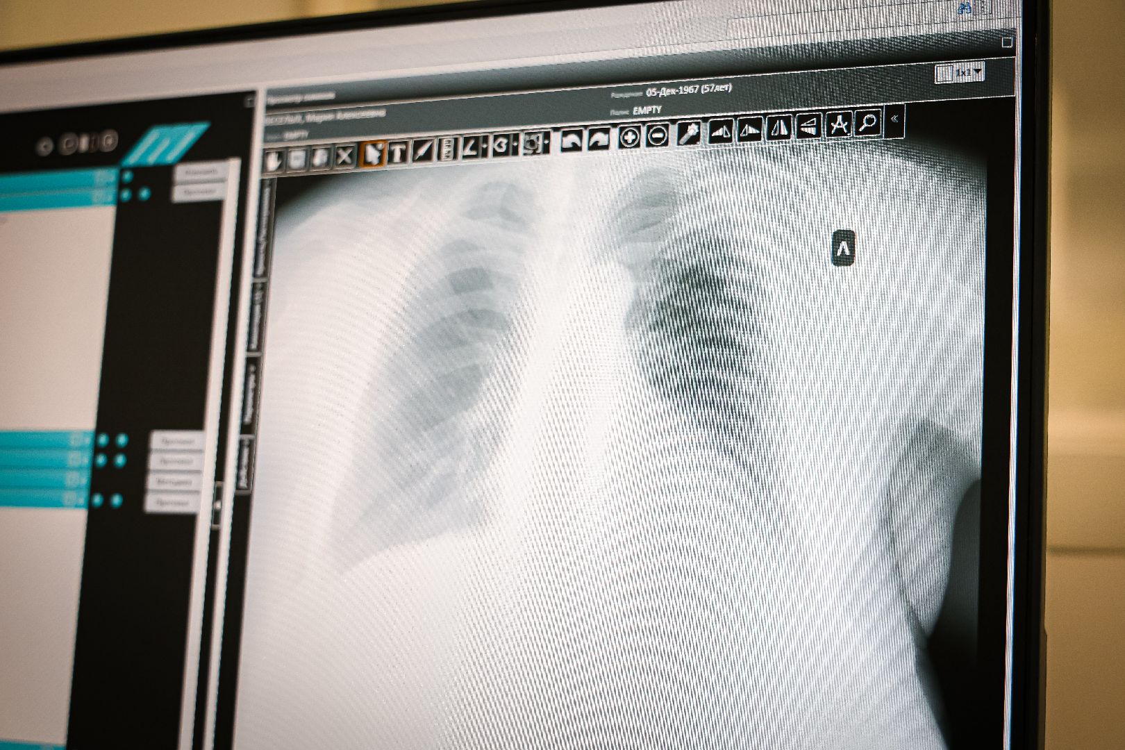 клин, общество, медицина, новое медоборудование, рентген-кабинет, подмосковье,