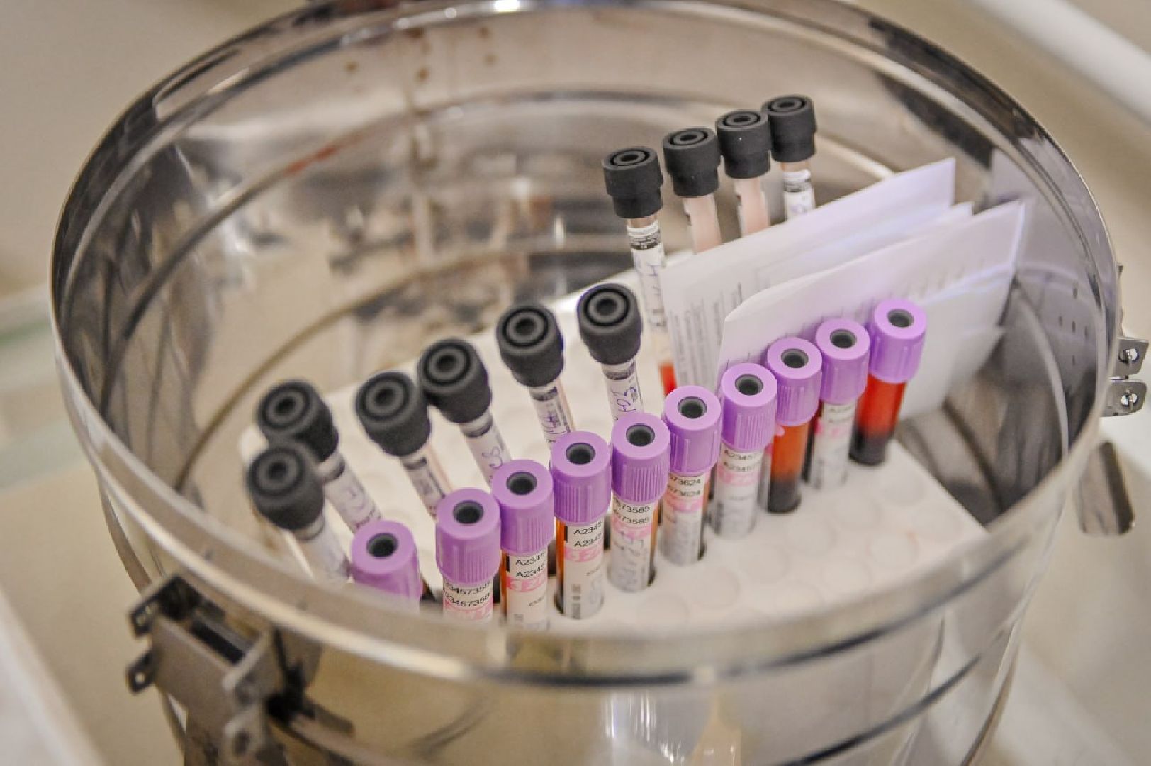 сергиев посад, сергиево-посадский городской округ, пересвет, фмба россии,диспансеризация, диспансеризация населения, выявление болезней на ранних стадиях,ЦМСЧ 94 ФМБА, цмсч 94,