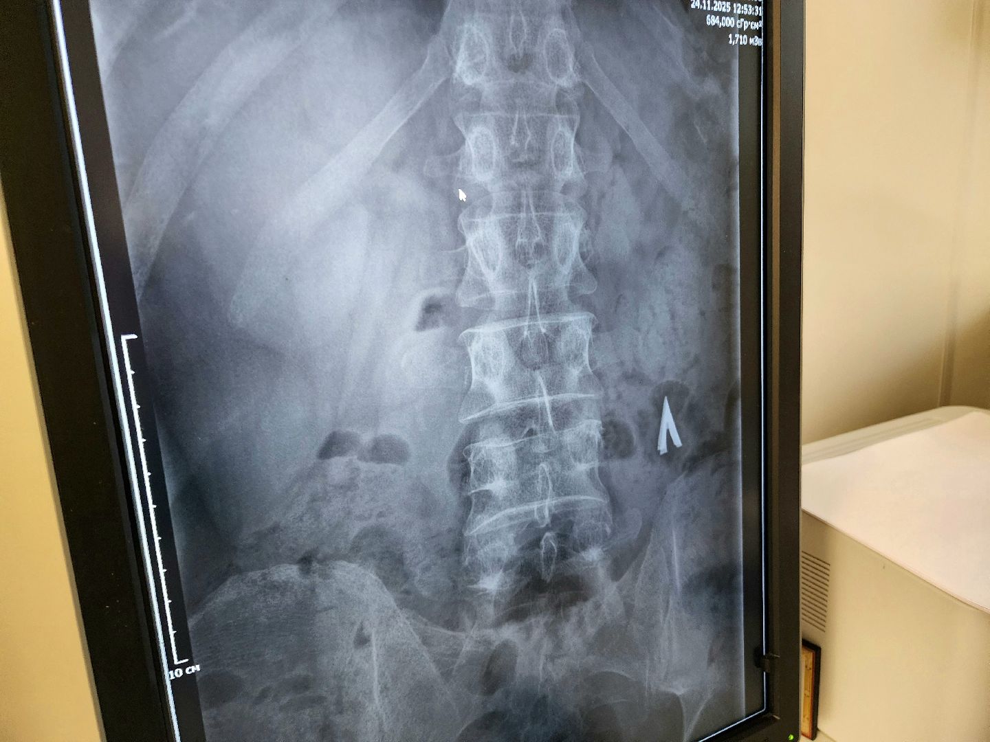 солнечногорск, медицина , здравоохранение, больница, жители ,