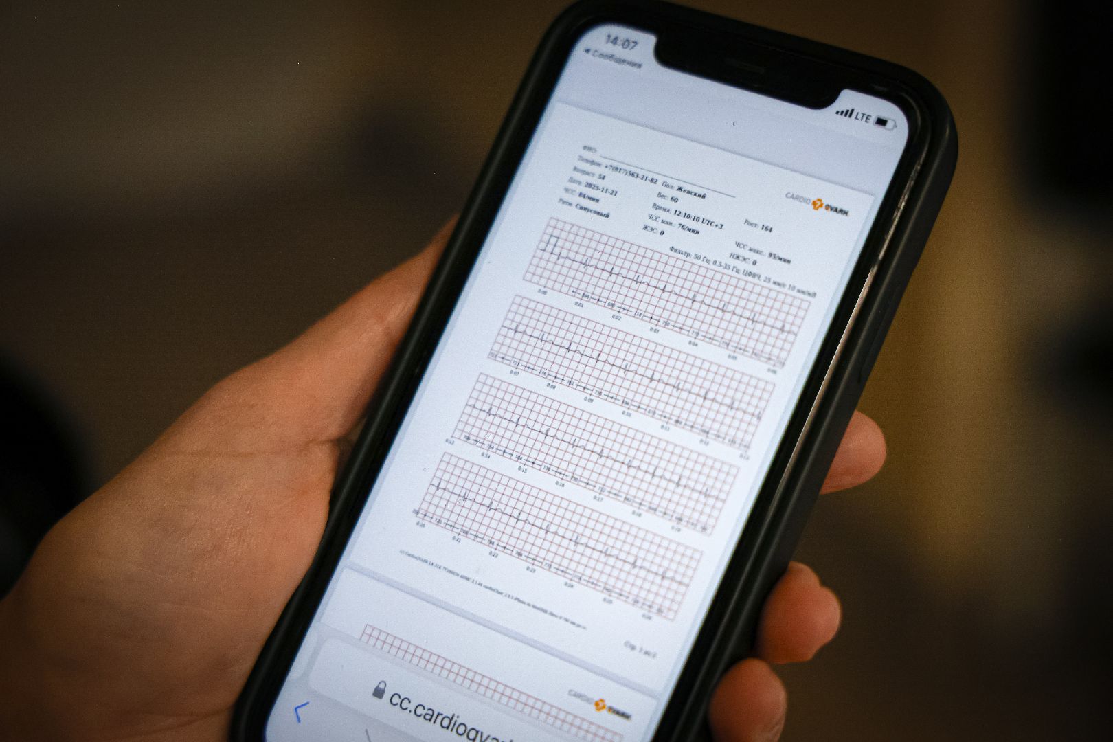 клин, общество, медицина, новое оборудование в больнице, здоровье сердца, подмосковье,