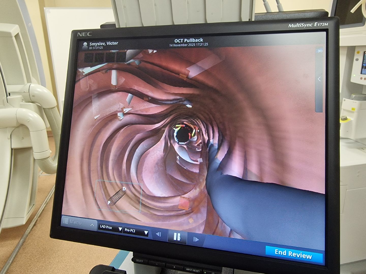 воскресенск, воскресенская больница, сосудистый центр,