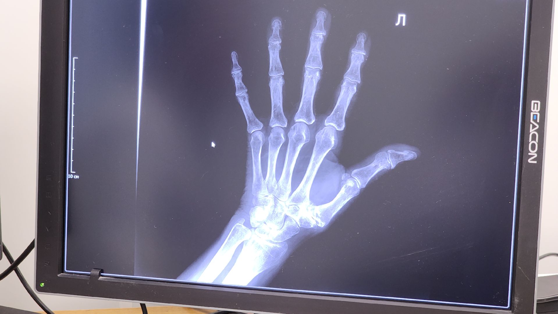 красногорск, медицина, рентген-аппарат, новое оборудование,