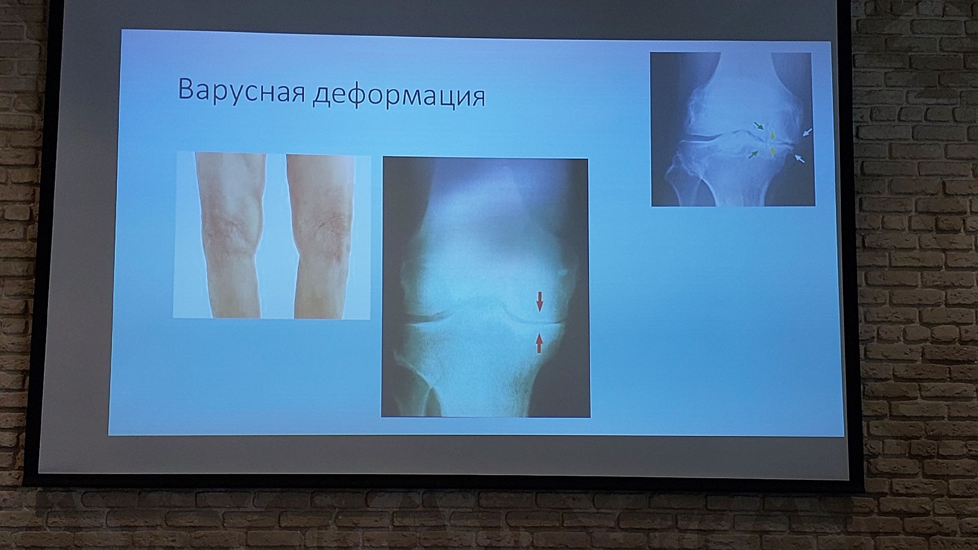 травмы, травматологи, серпухов, конференция травматологов, медицина,