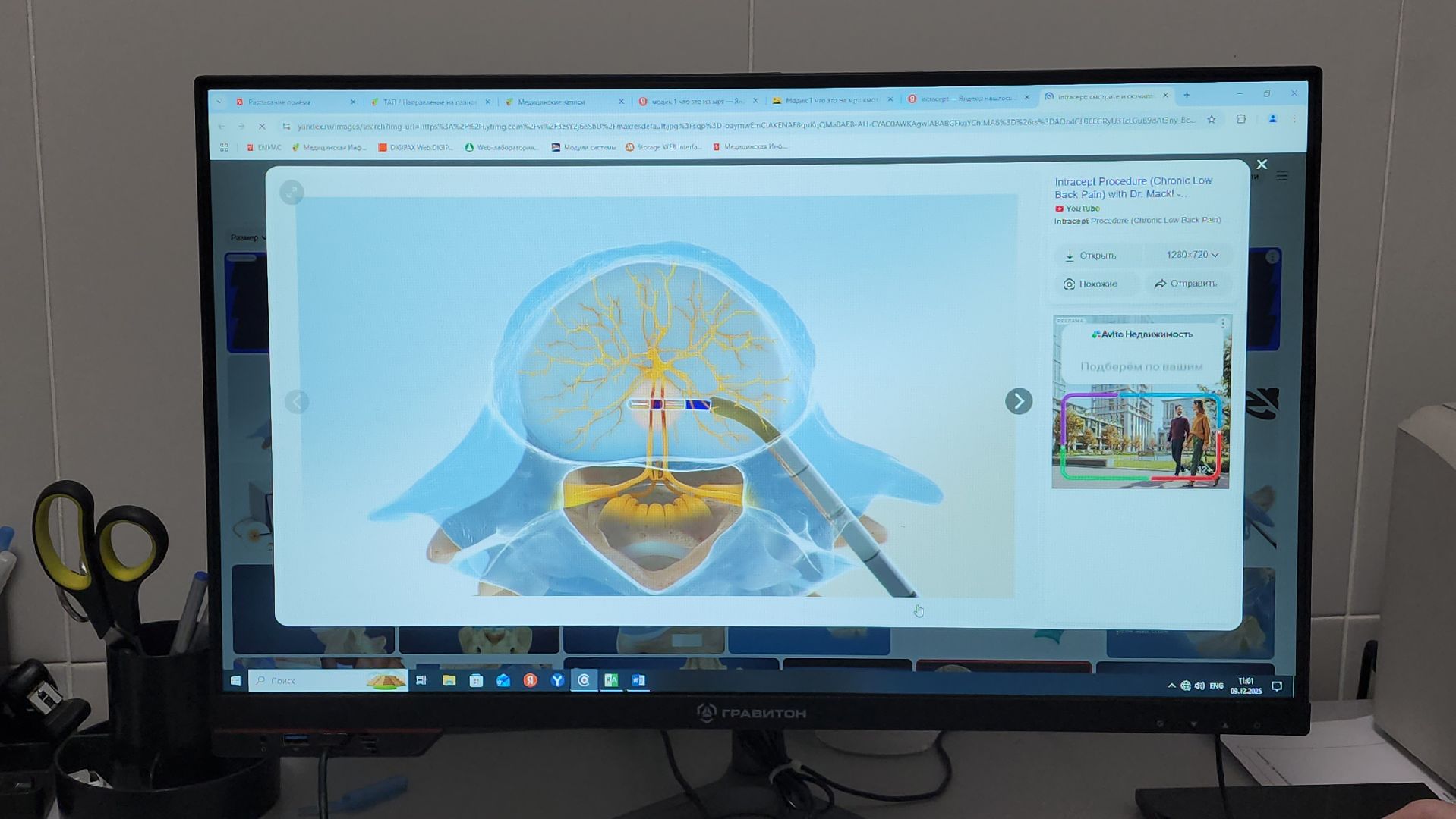 лечение боли, красногорск медицина, операция,