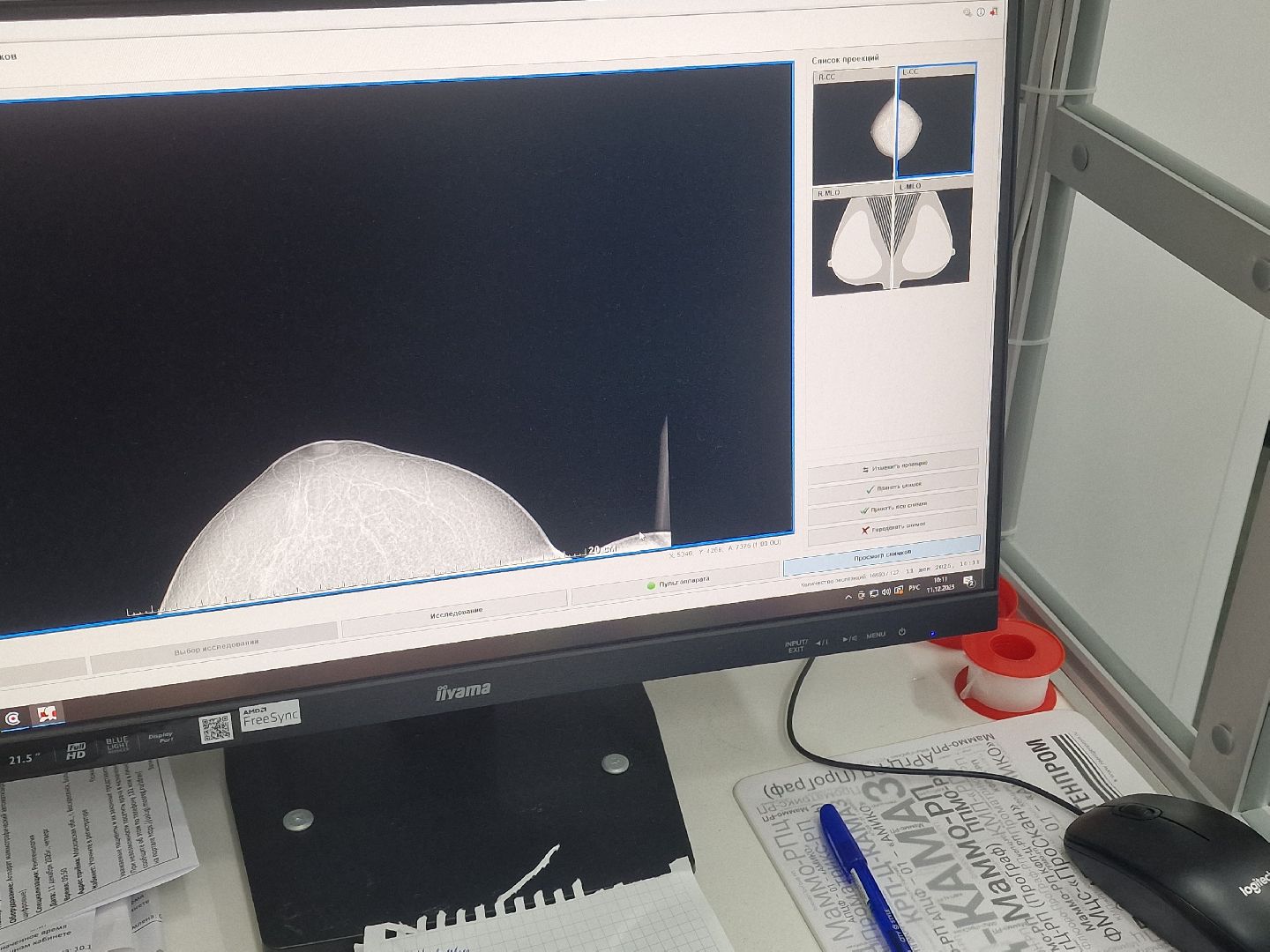 воскресенск, передвижной маммограф,